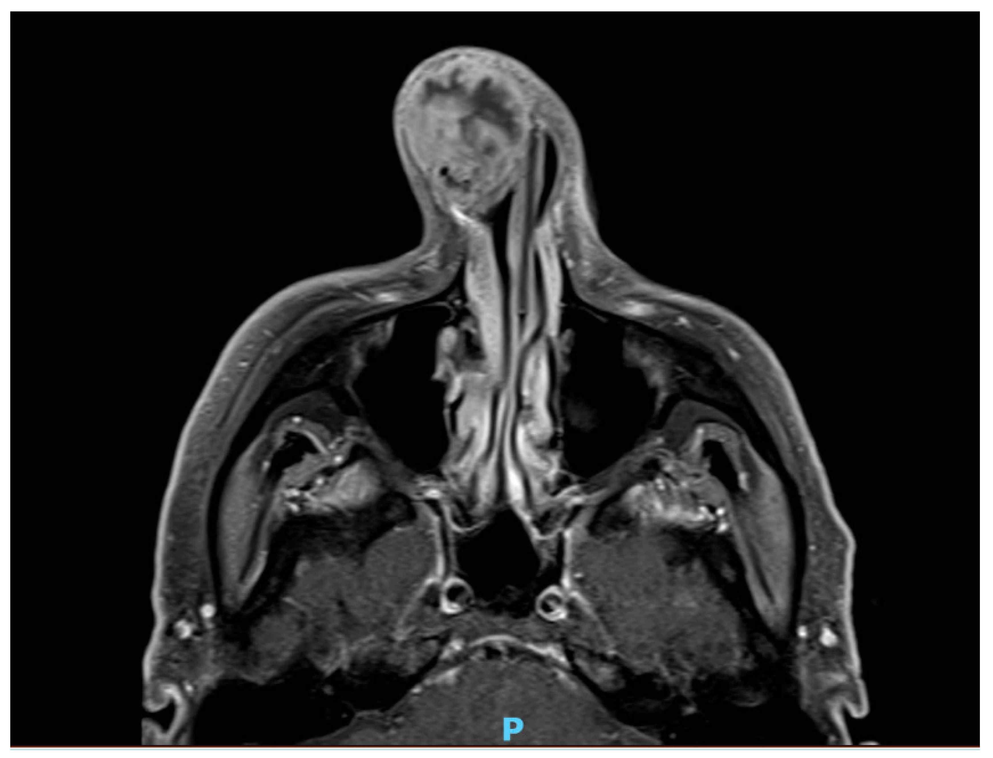 Medicina 55 00128 g002