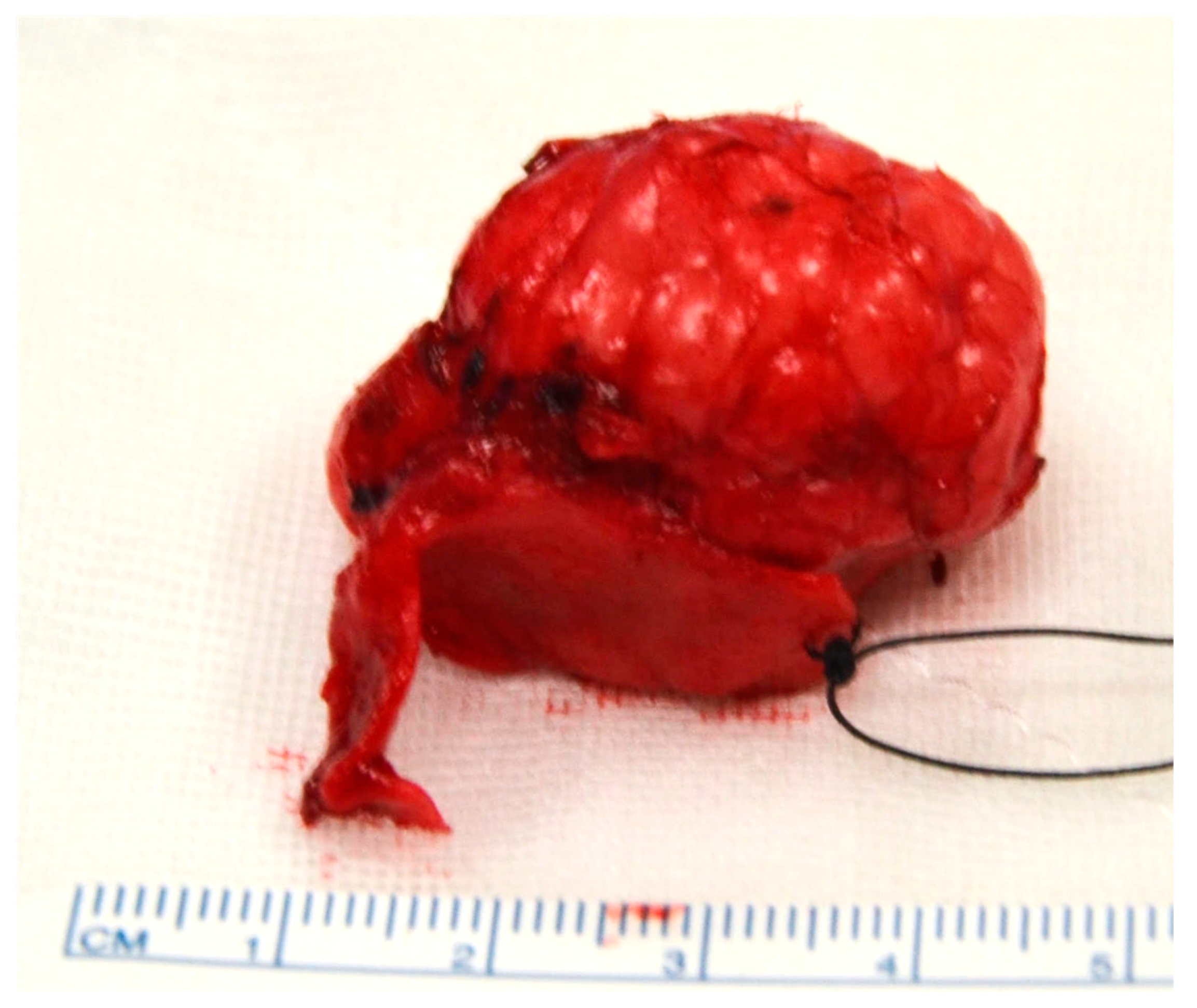 Medicina 55 00128 g004