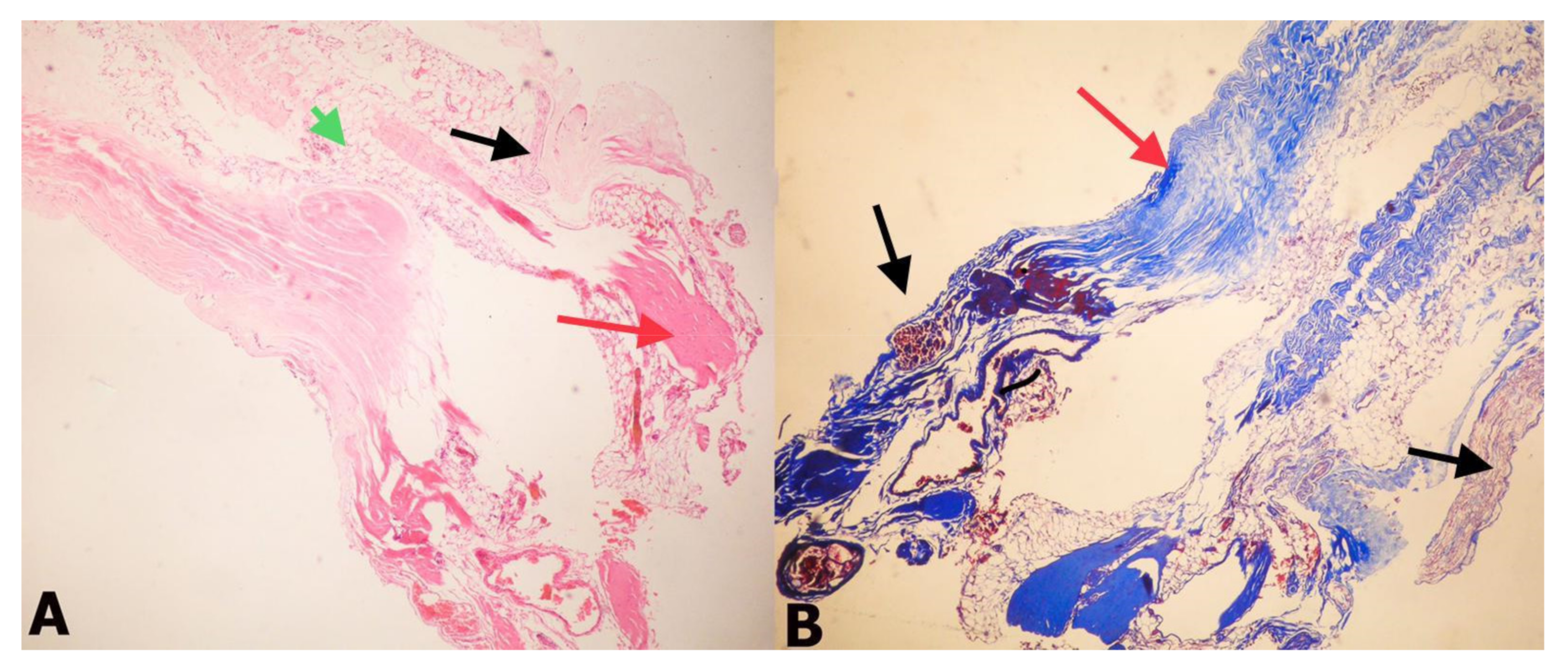 Medicina 55 00133 g002 Medicina 55 00133 g002