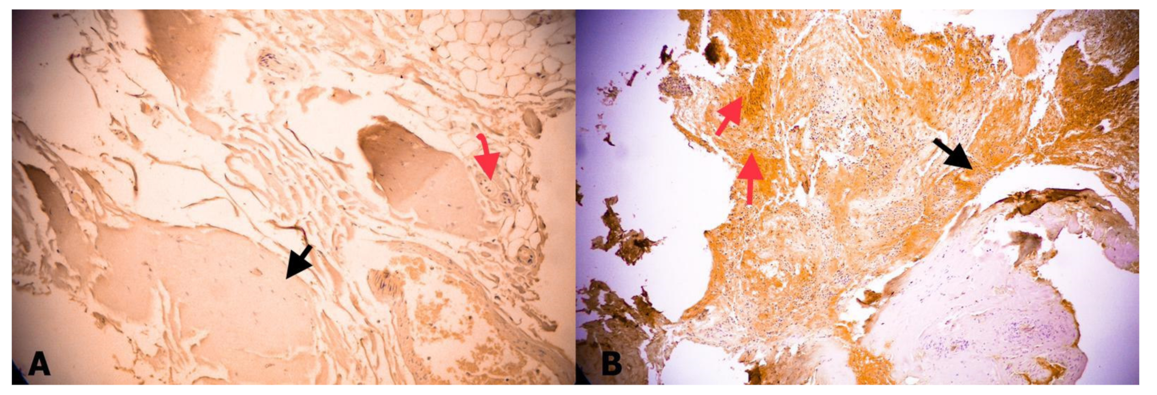 Medicina 55 00133 g005 Medicina 55 00133 g005