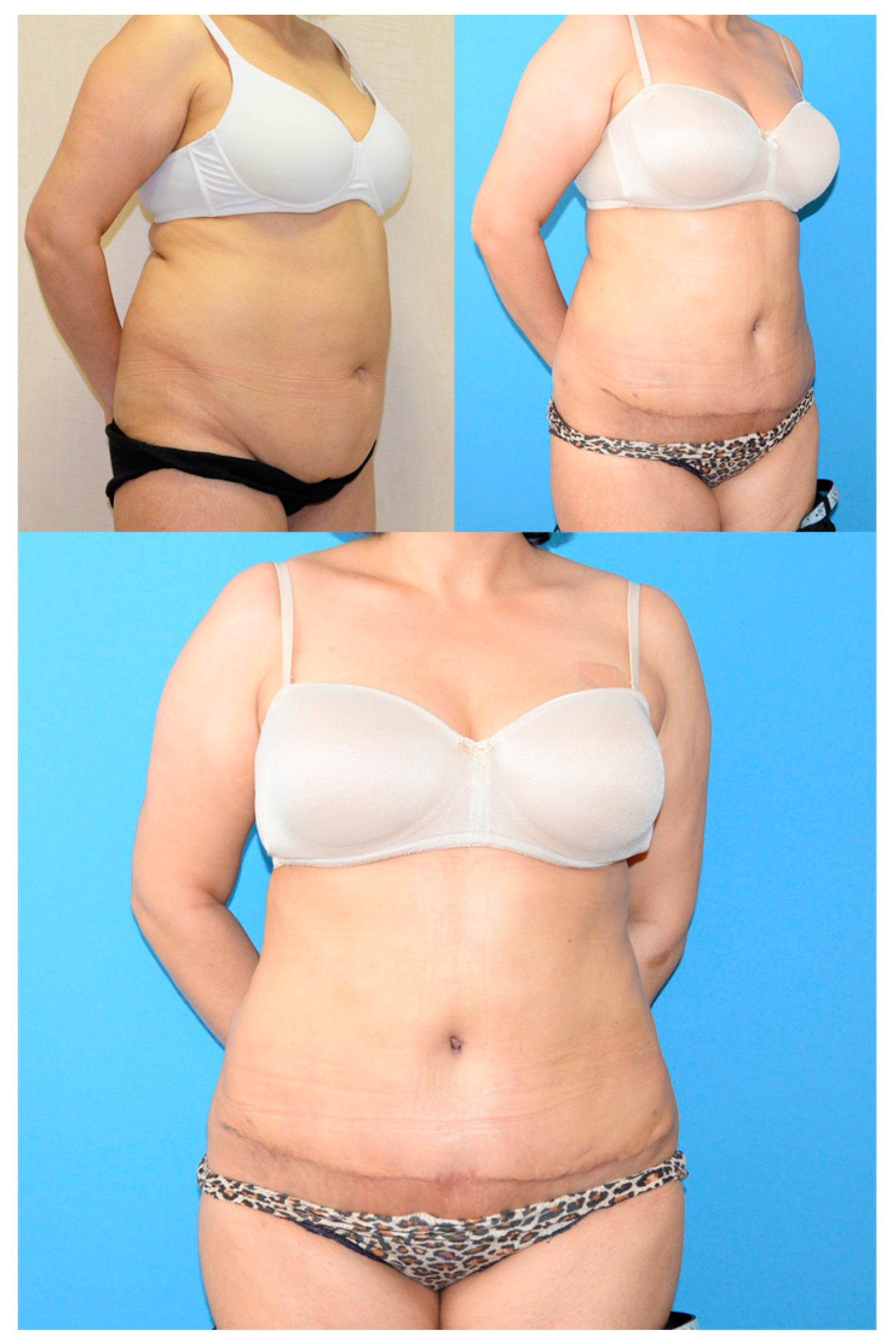 Medicina 55 00142 g001