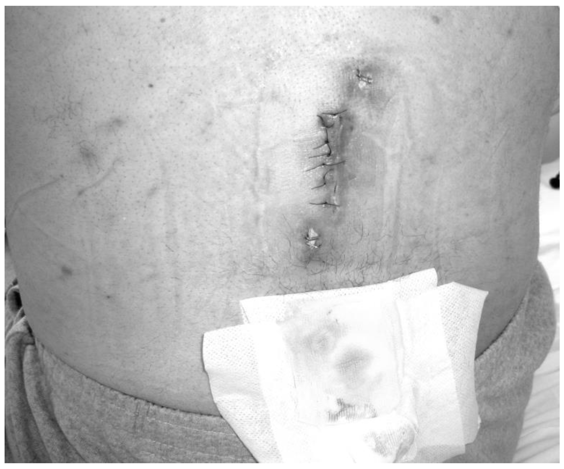 Medicina 55 00164 g001 550