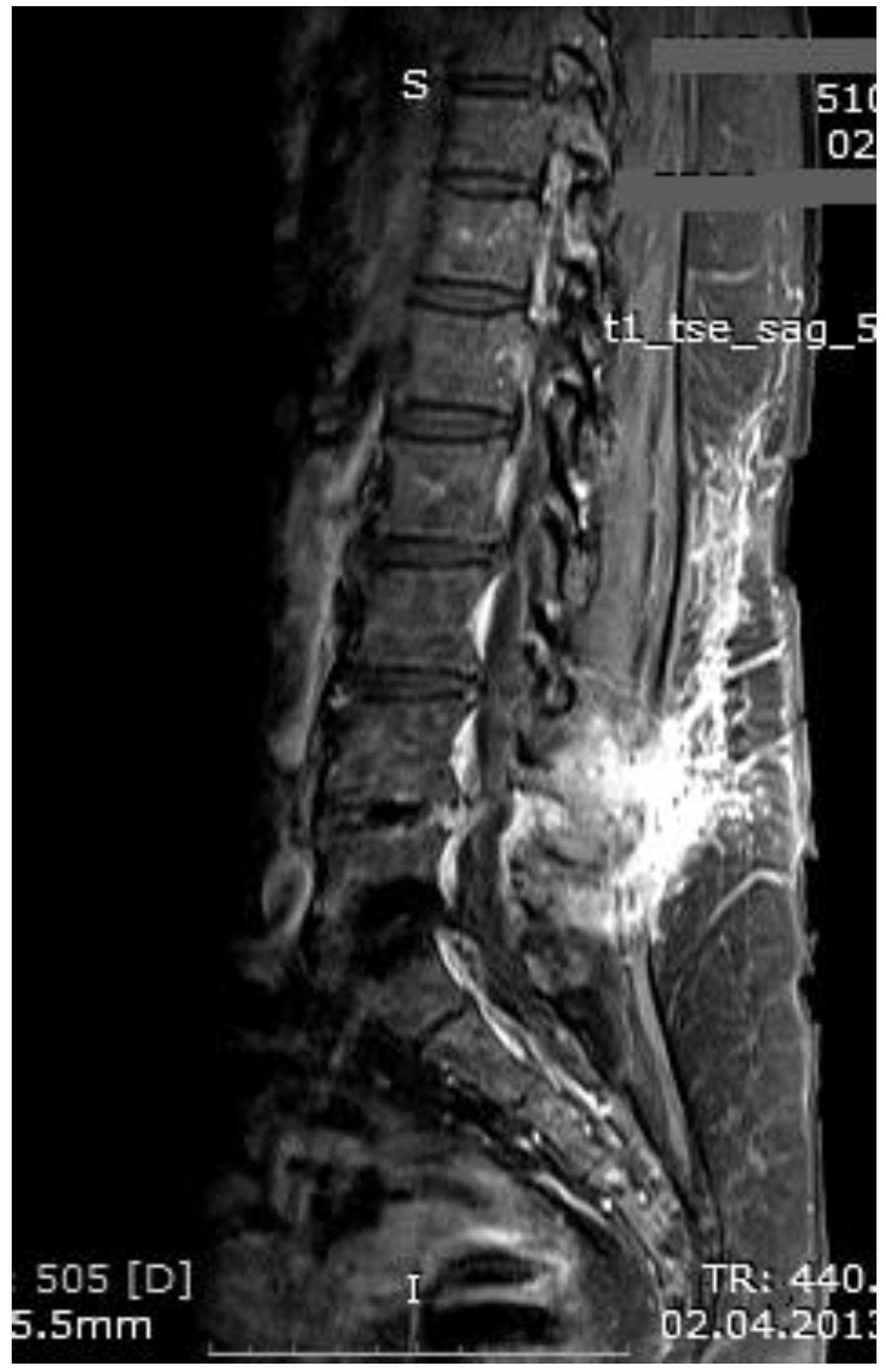 Medicina 55 00164 g003 550