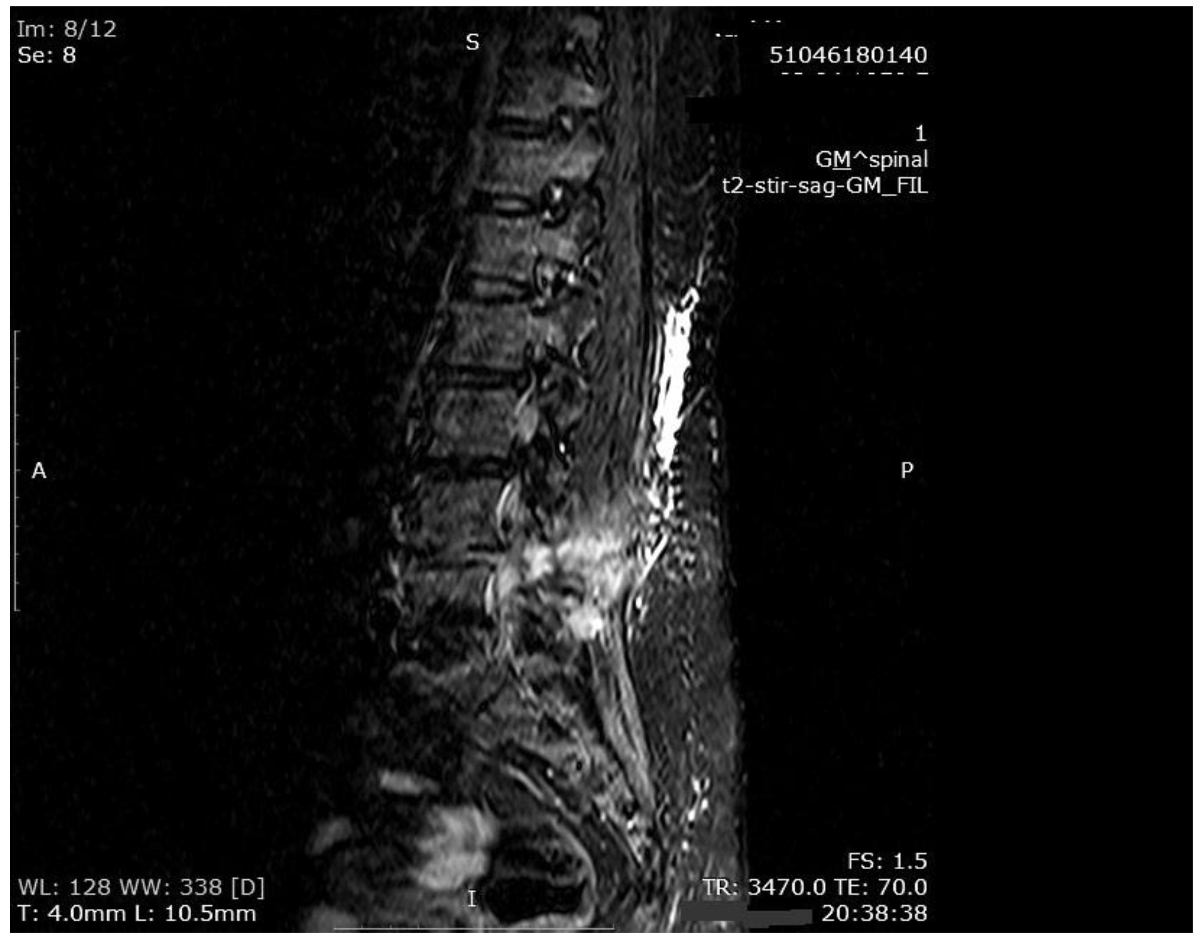 Medicina 55 00164 g004 550