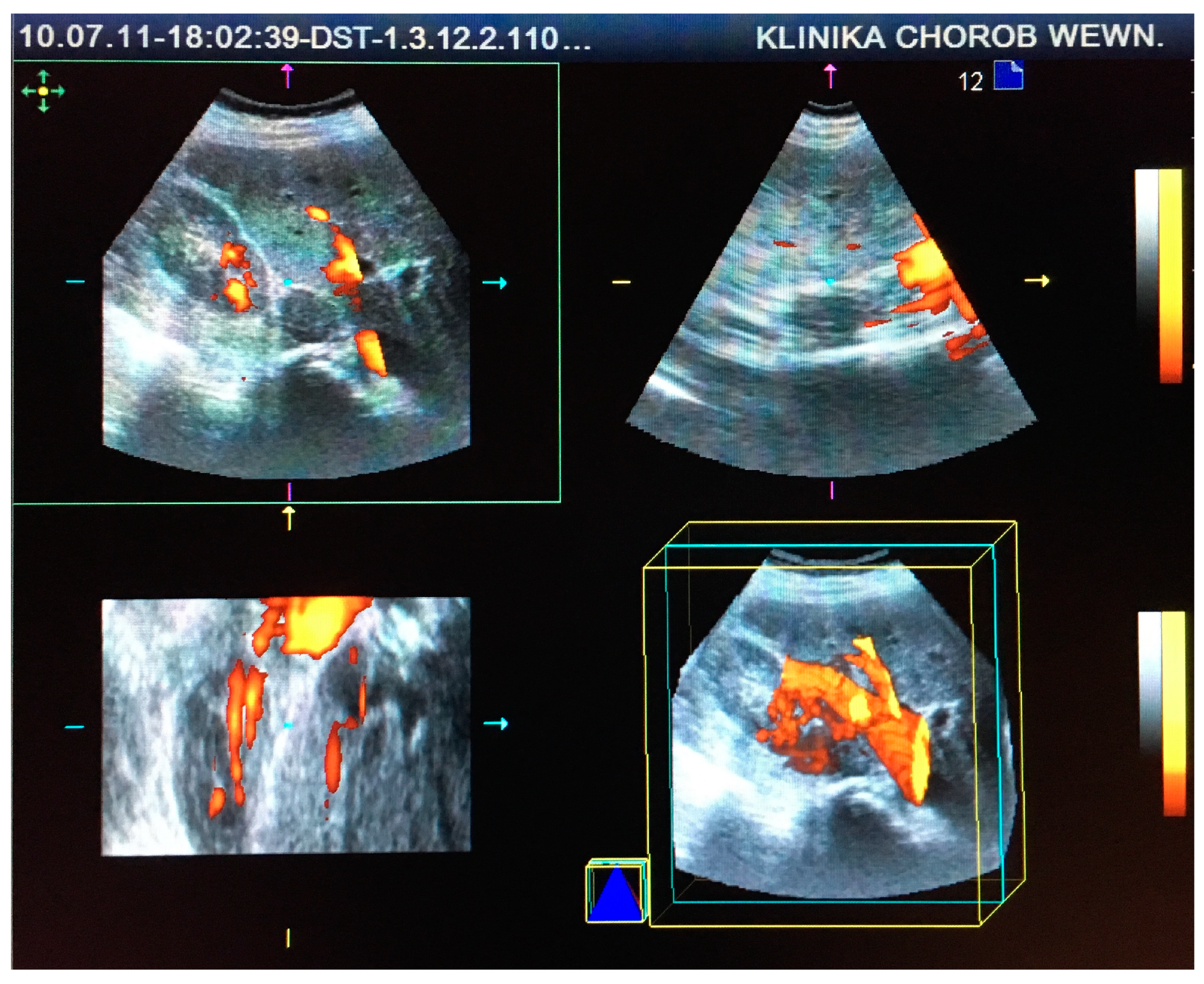 Medicina 55 00165 g002