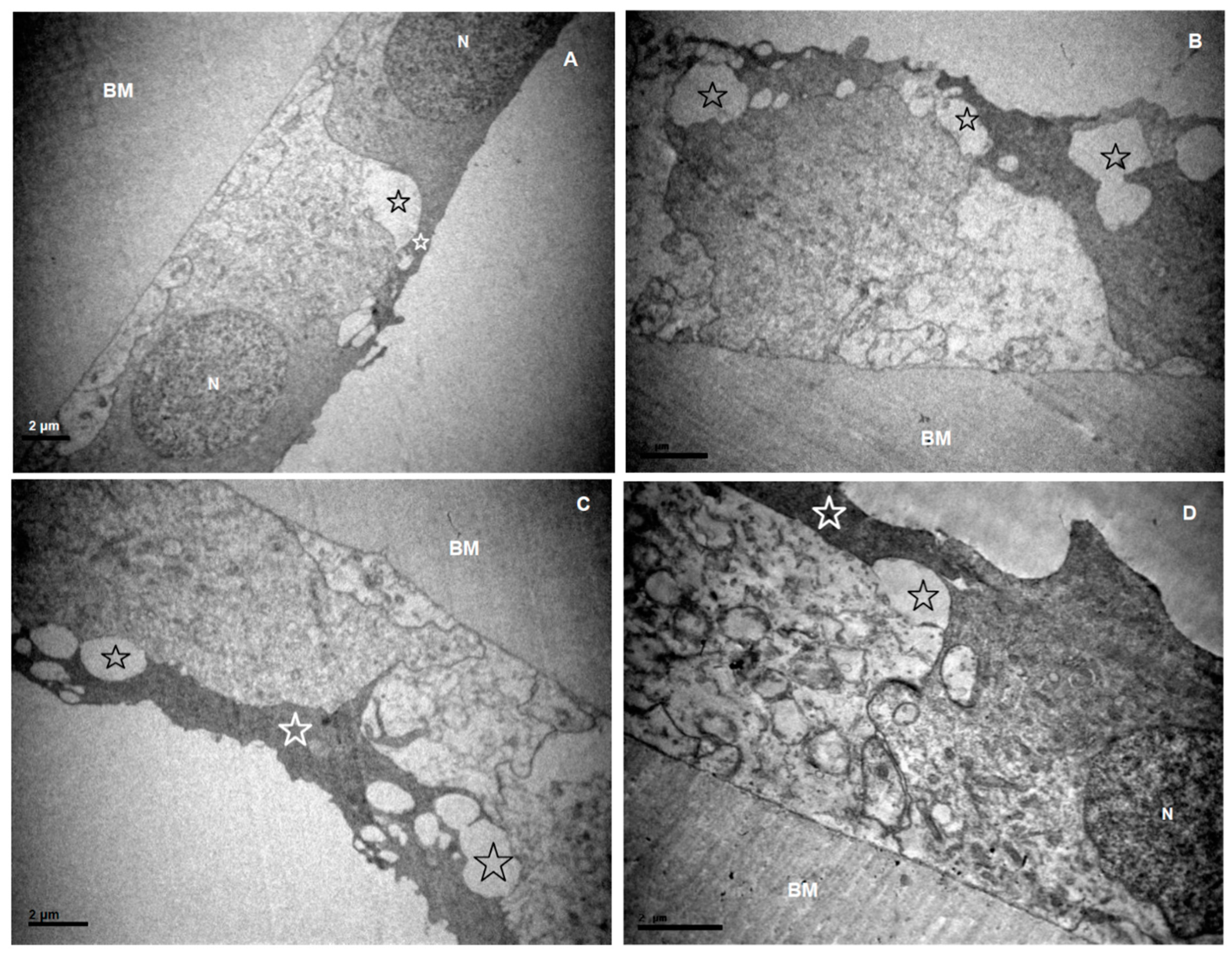 Current Research in Ophthalmic Electron Microscopy