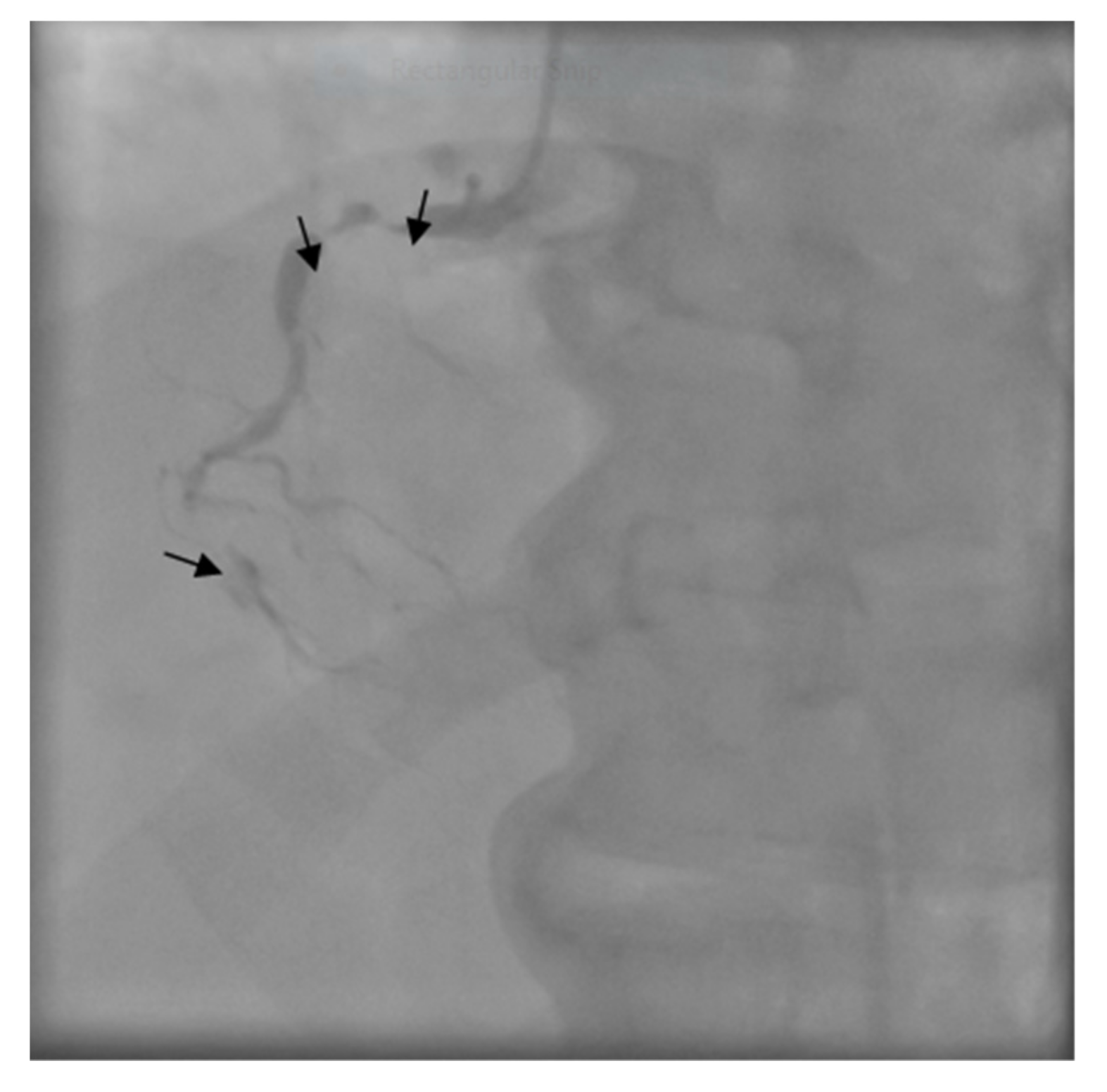 Medicina 55 00242 g006