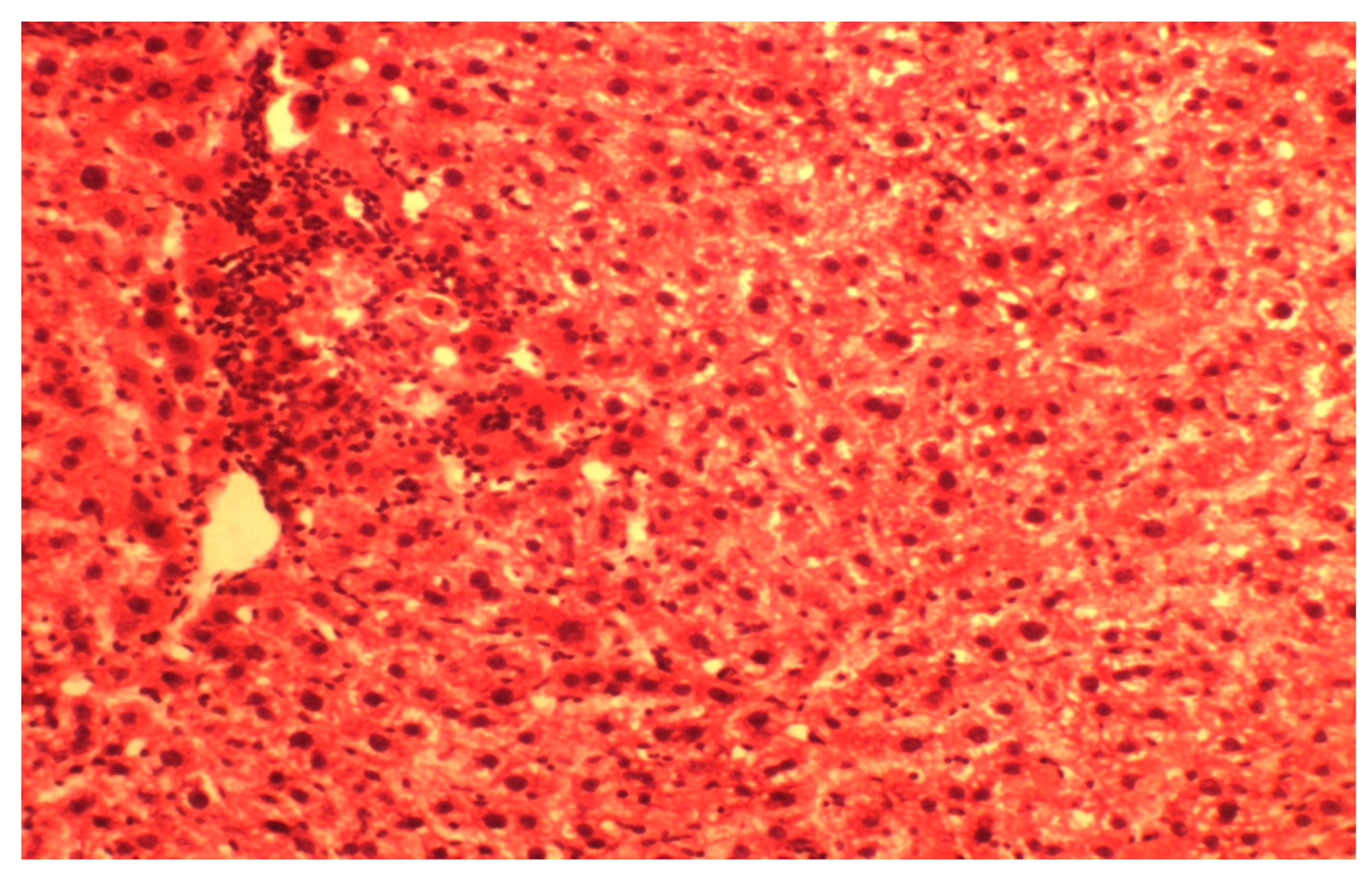 Medicina 55 00304 g002 Medicina 55 00304 g002