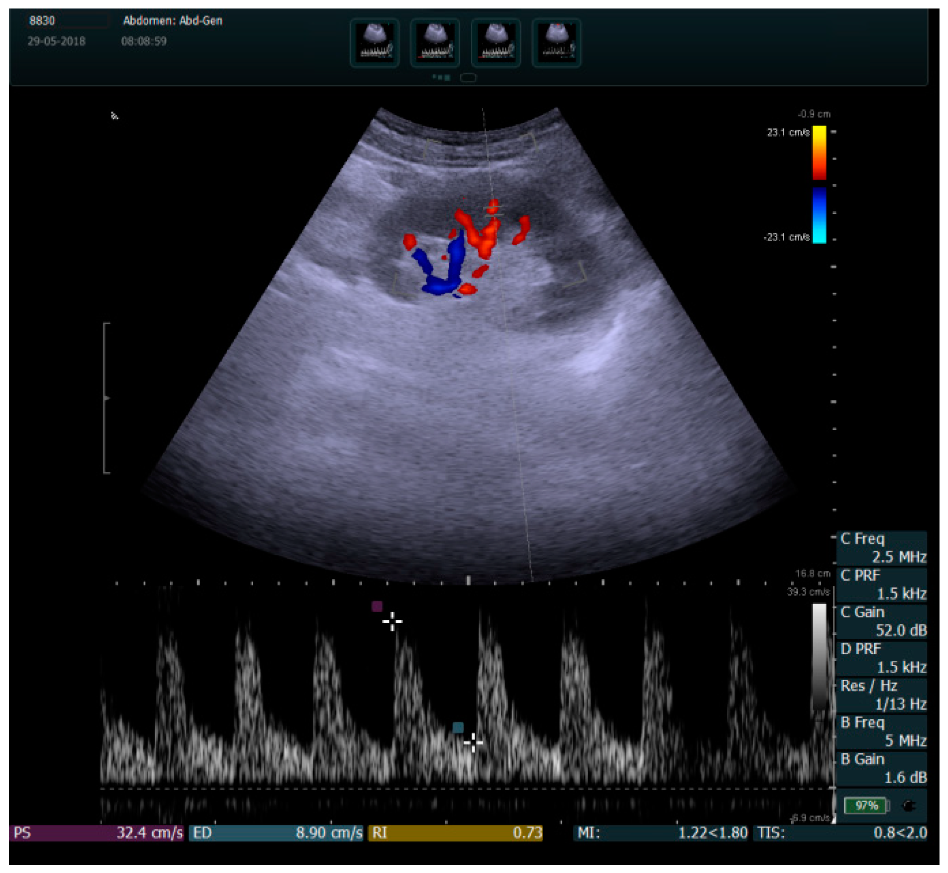 Medicina Free Full Text Correlations Between Vascular Stiffness Indicators Opg And 25 Oh Vitamin D3 Status In Heart Failure Patients Html
