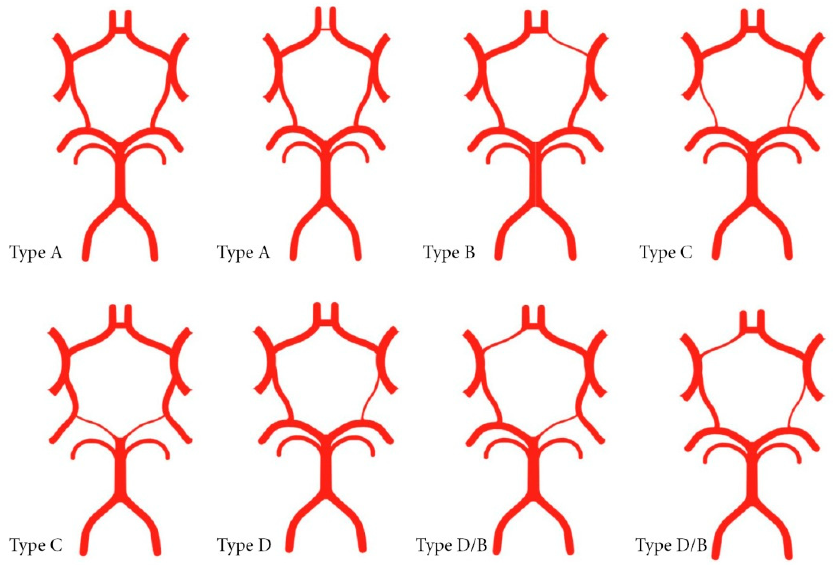 Circle of willis variant anatomy