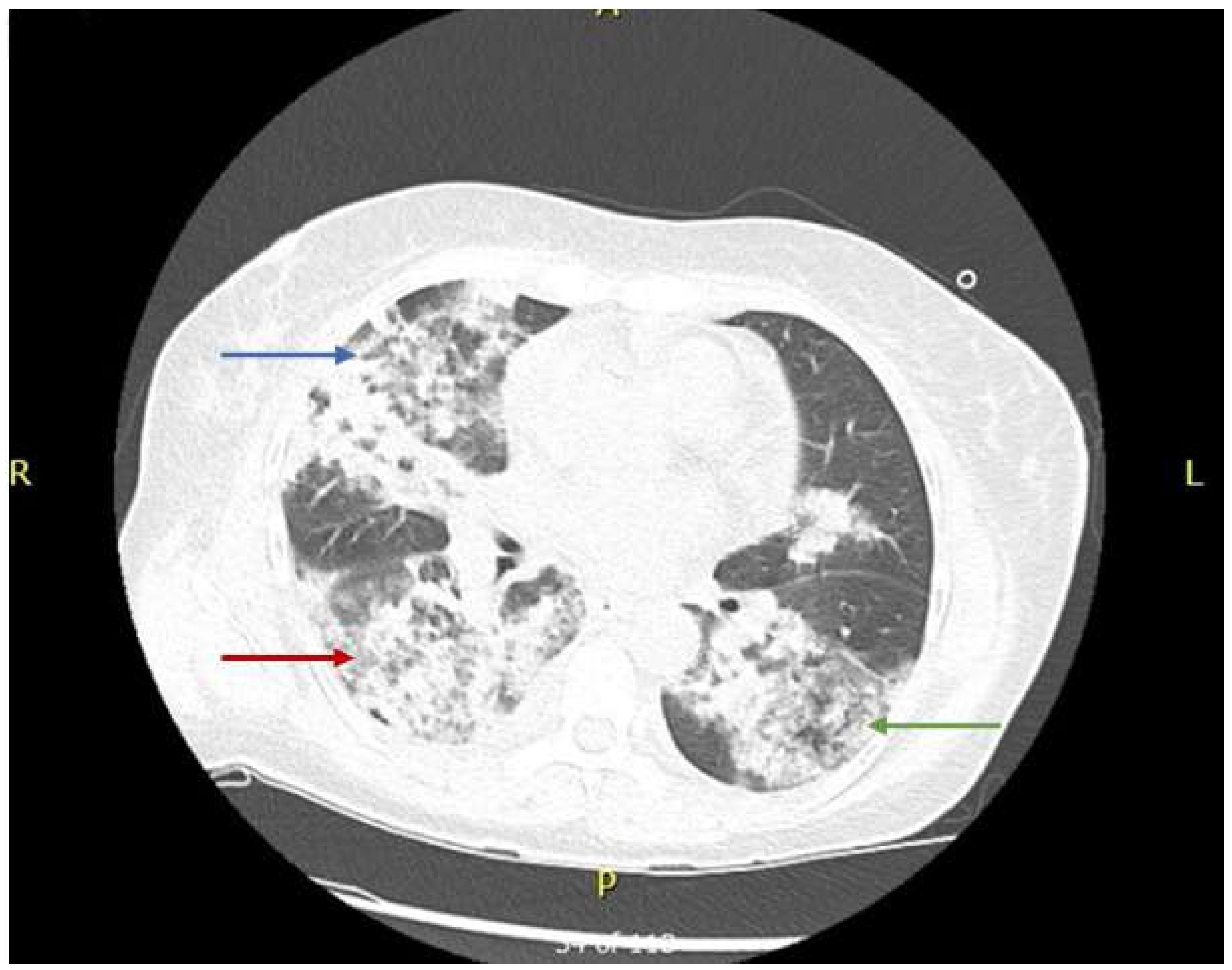 Medicina 55 00378 g002