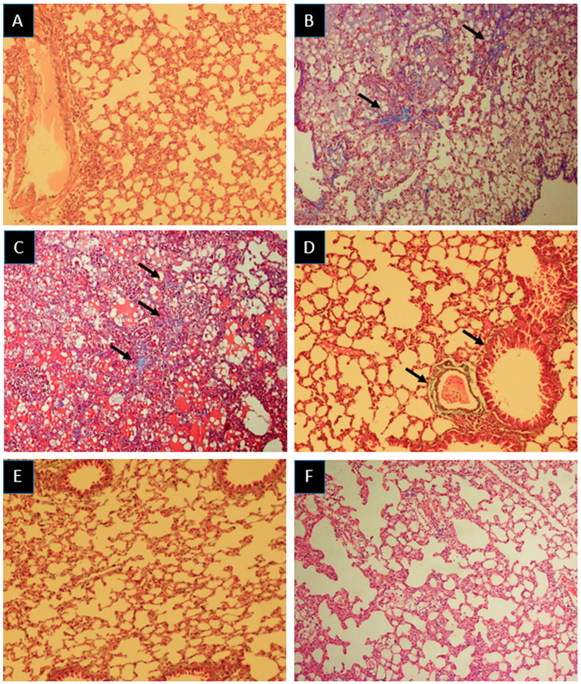 Medicina 55 00417 g002 Medicina 55 00417 g002
