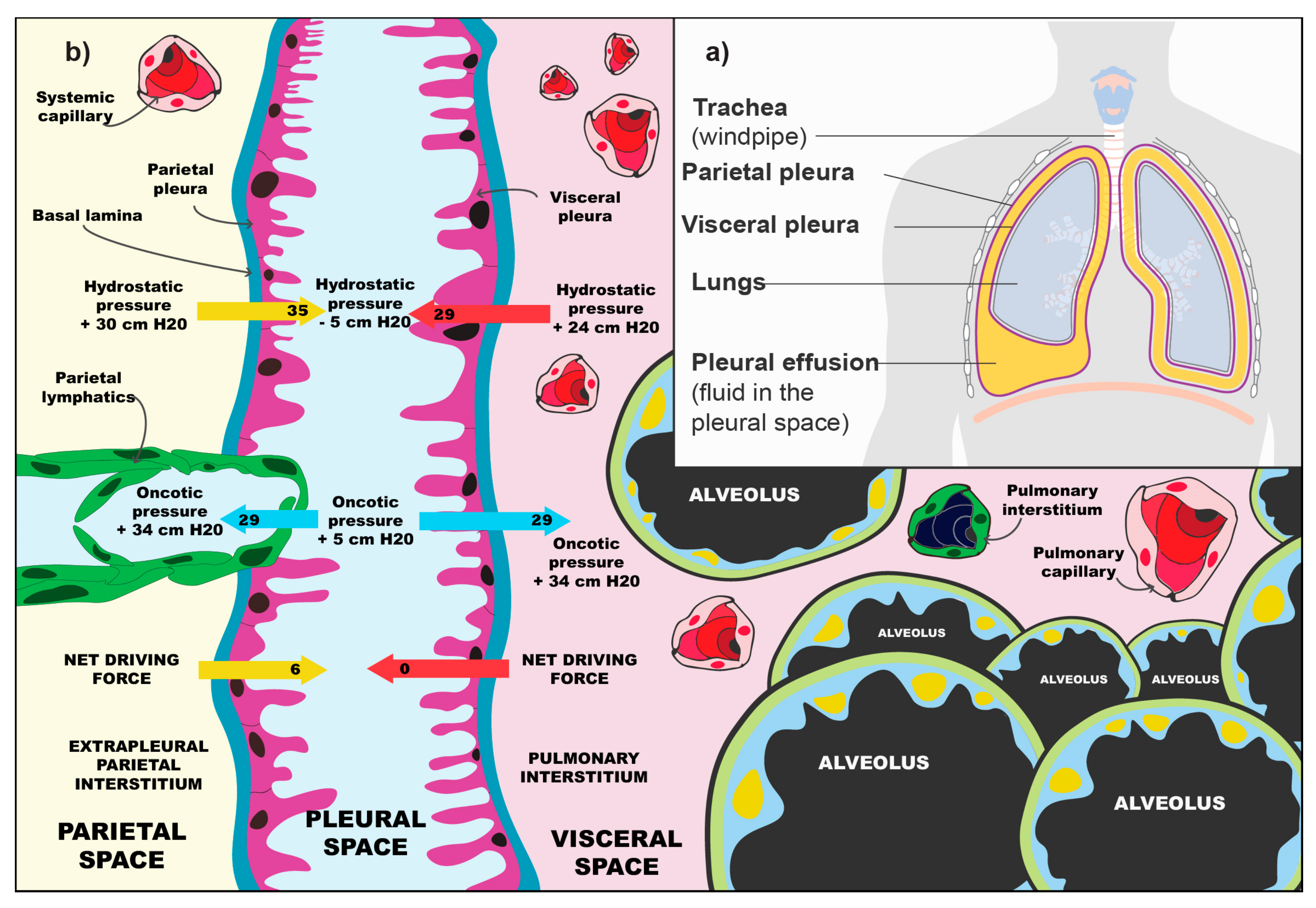 how long can you live with advanced gallbladder cancer