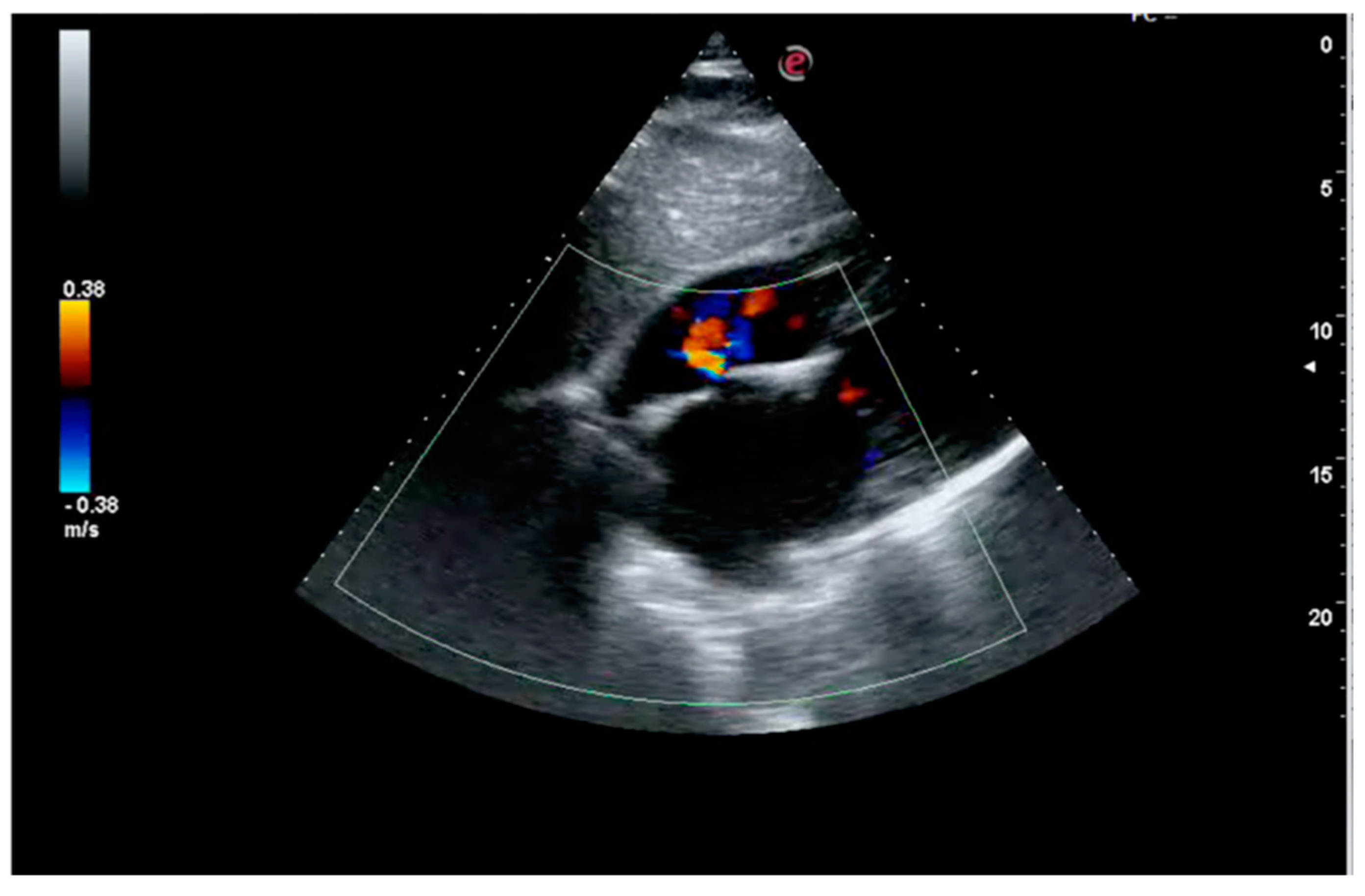 Medicina 55 00505 g002 Medicina 55 00505 g002