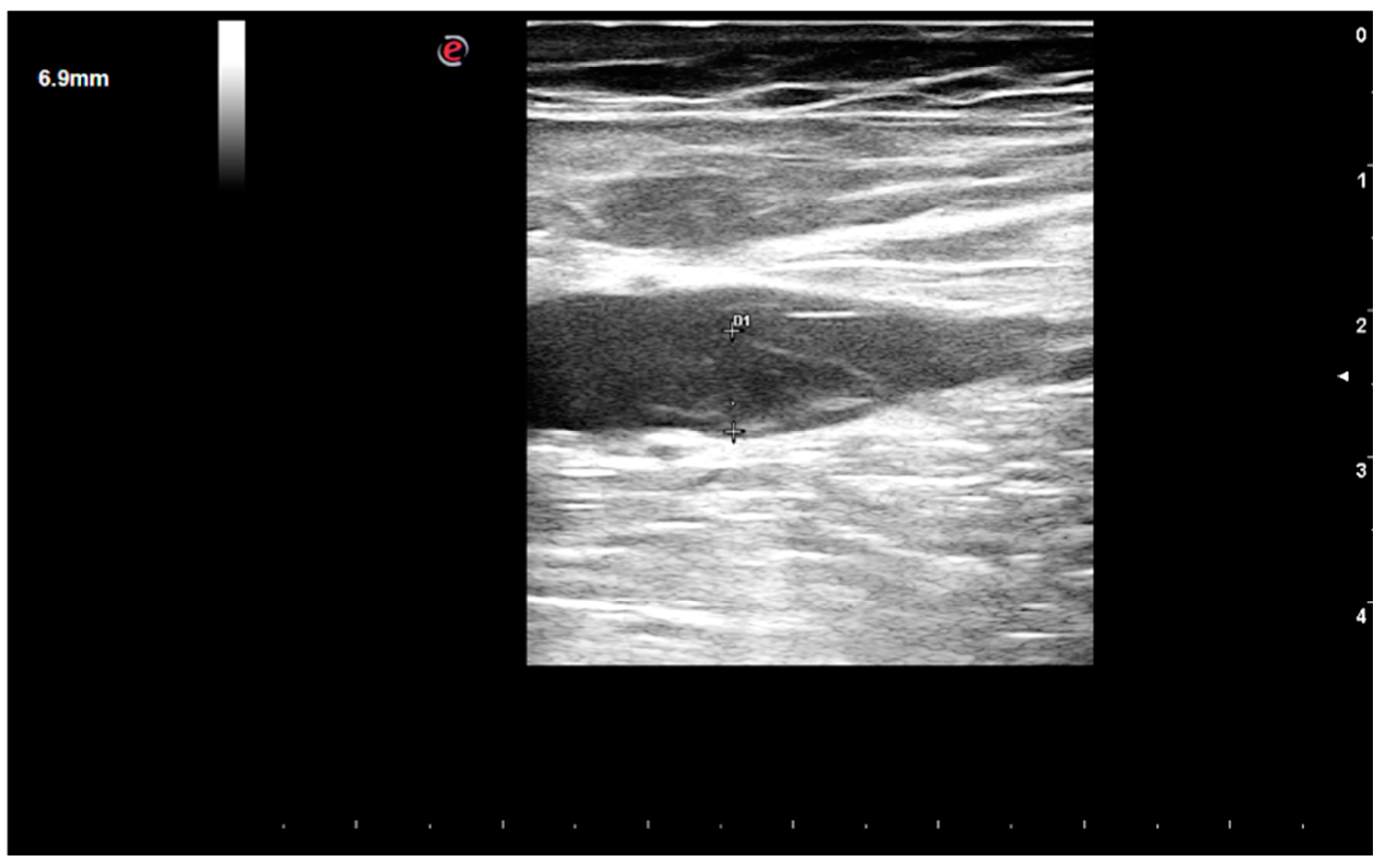 Medicina 55 00505 g003 Medicina 55 00505 g003