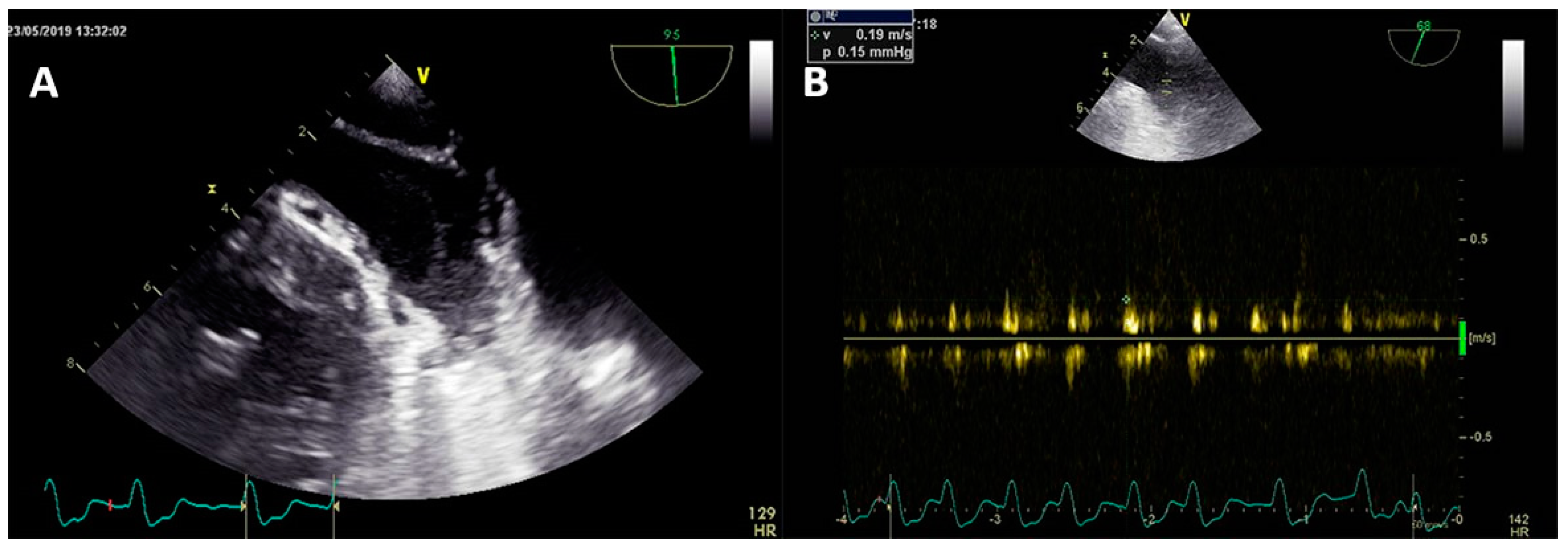 Medicina 55 00511 g002