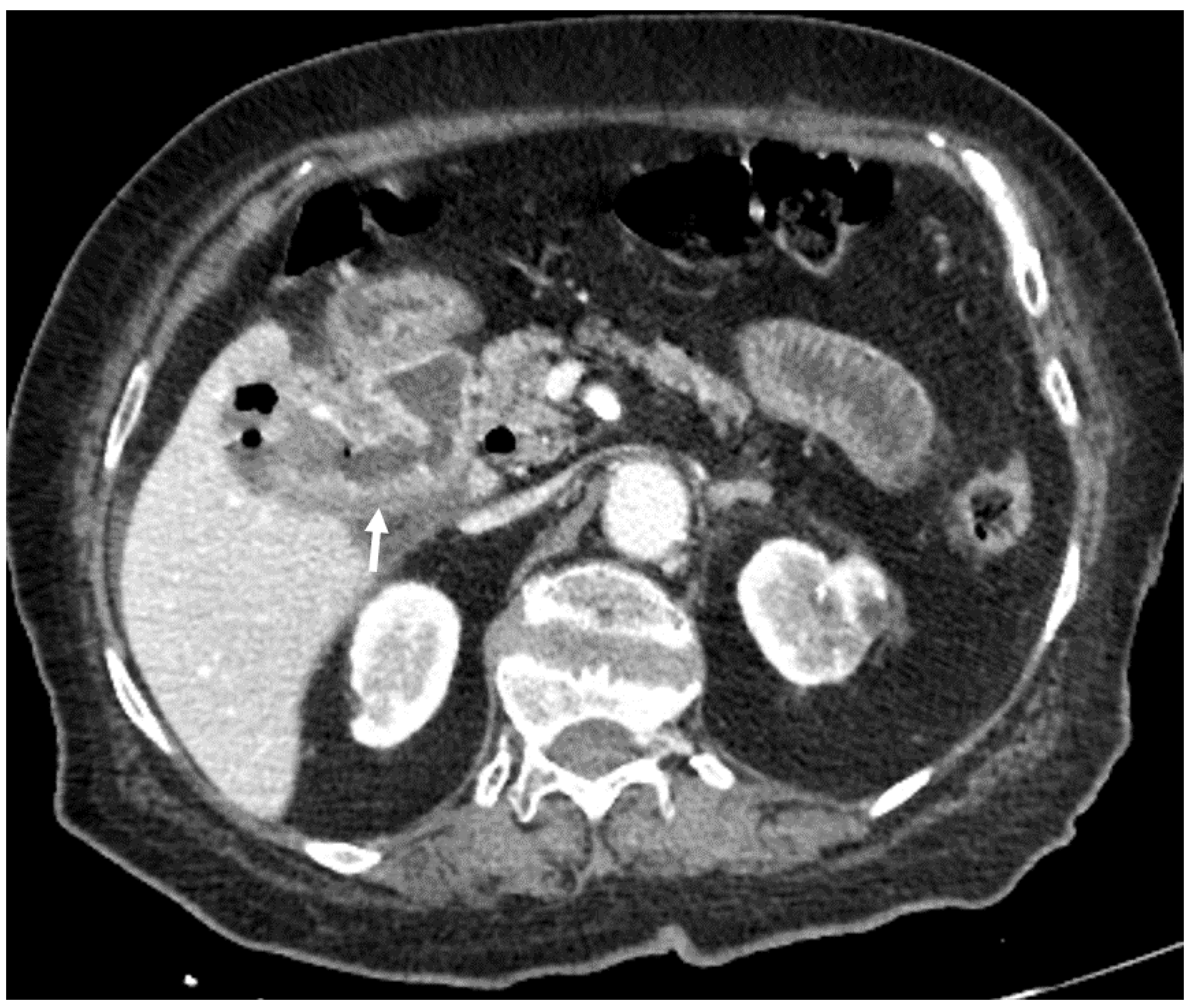 Medicina 55 00598 g004