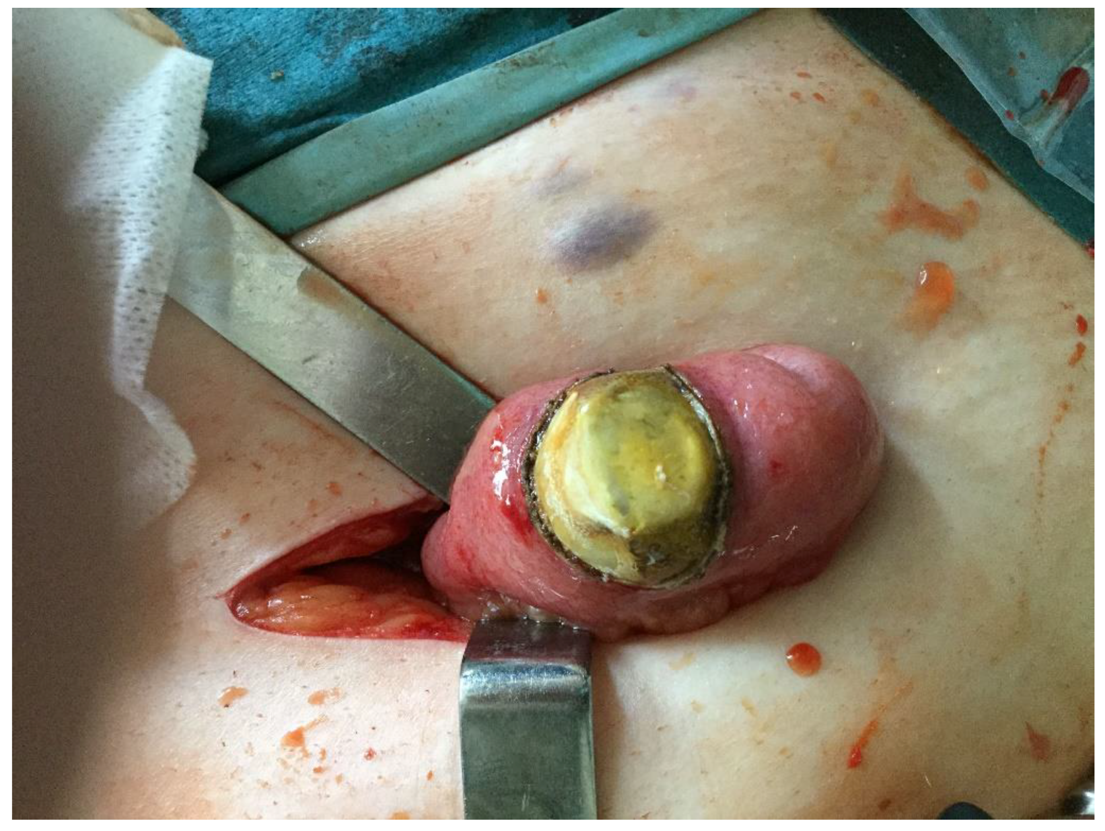 Medicina 55 00598 g006