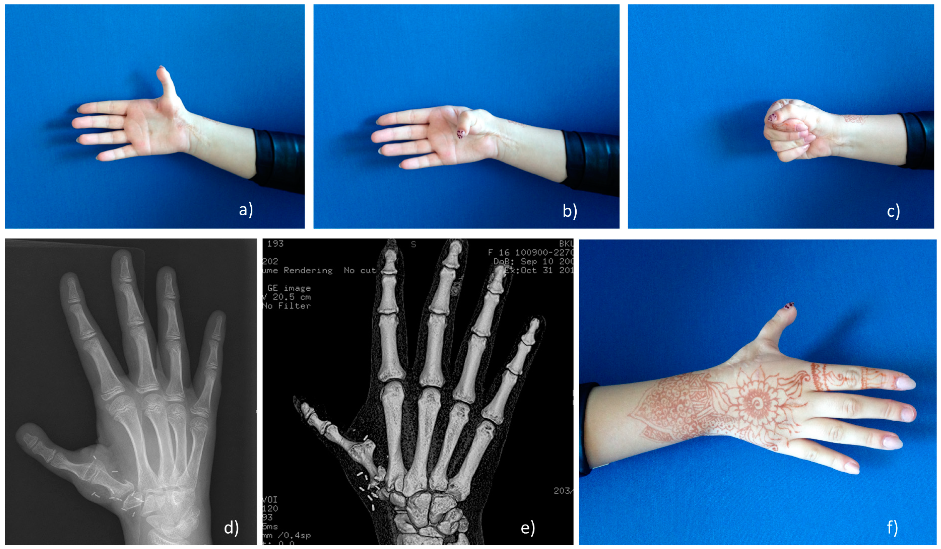 Medicina 55 00610 g005 550