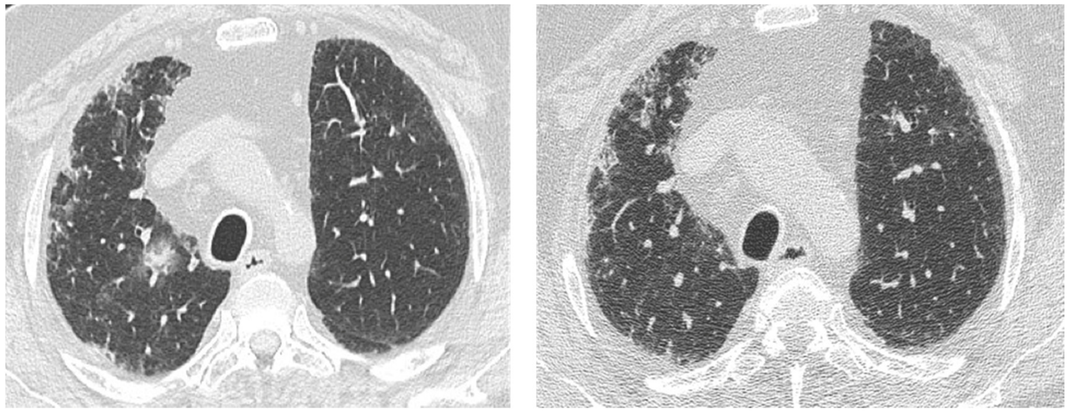 Medicina 55 00613 g006 550