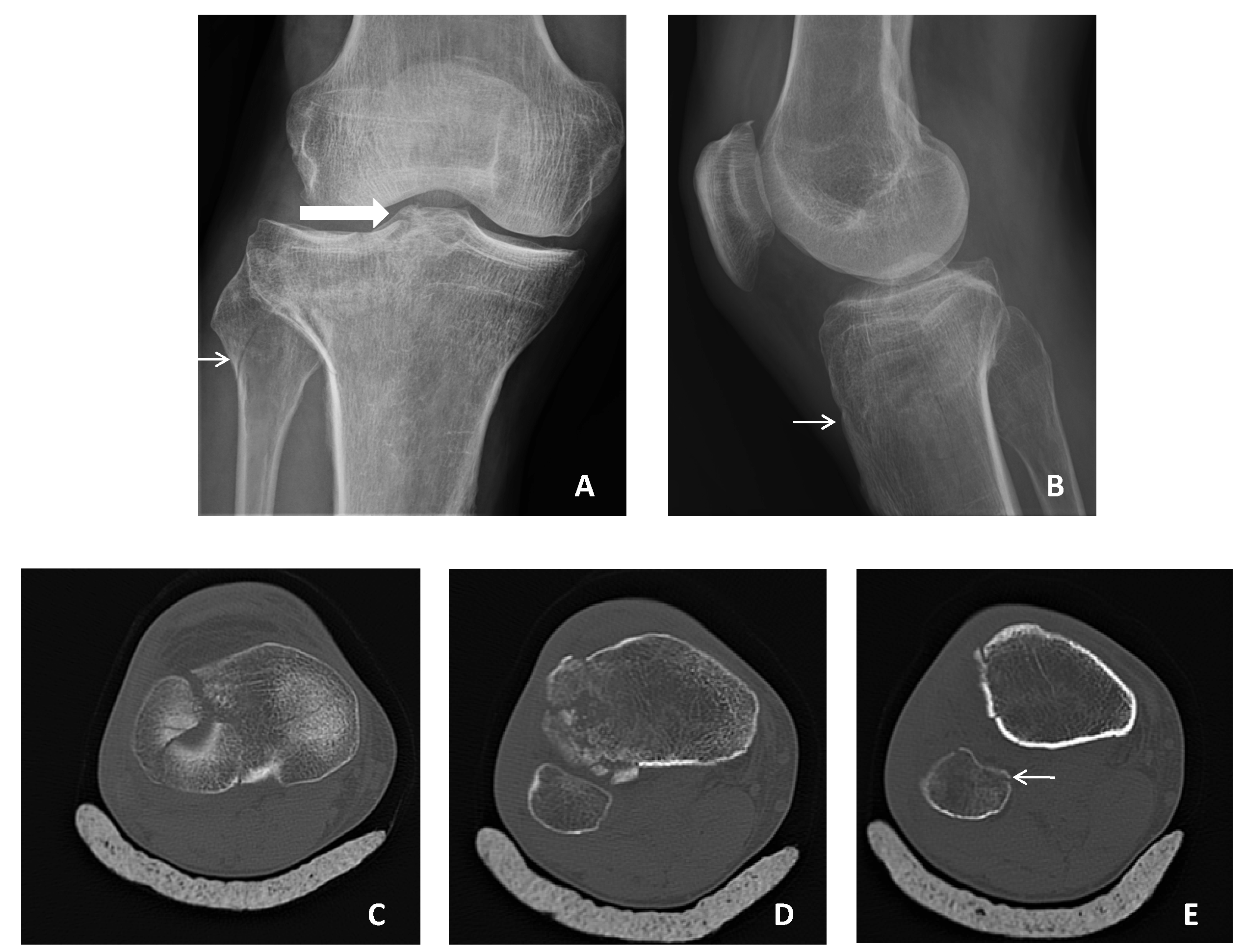 Medicina Free Full Text Comparison Of X Ray Imaging And