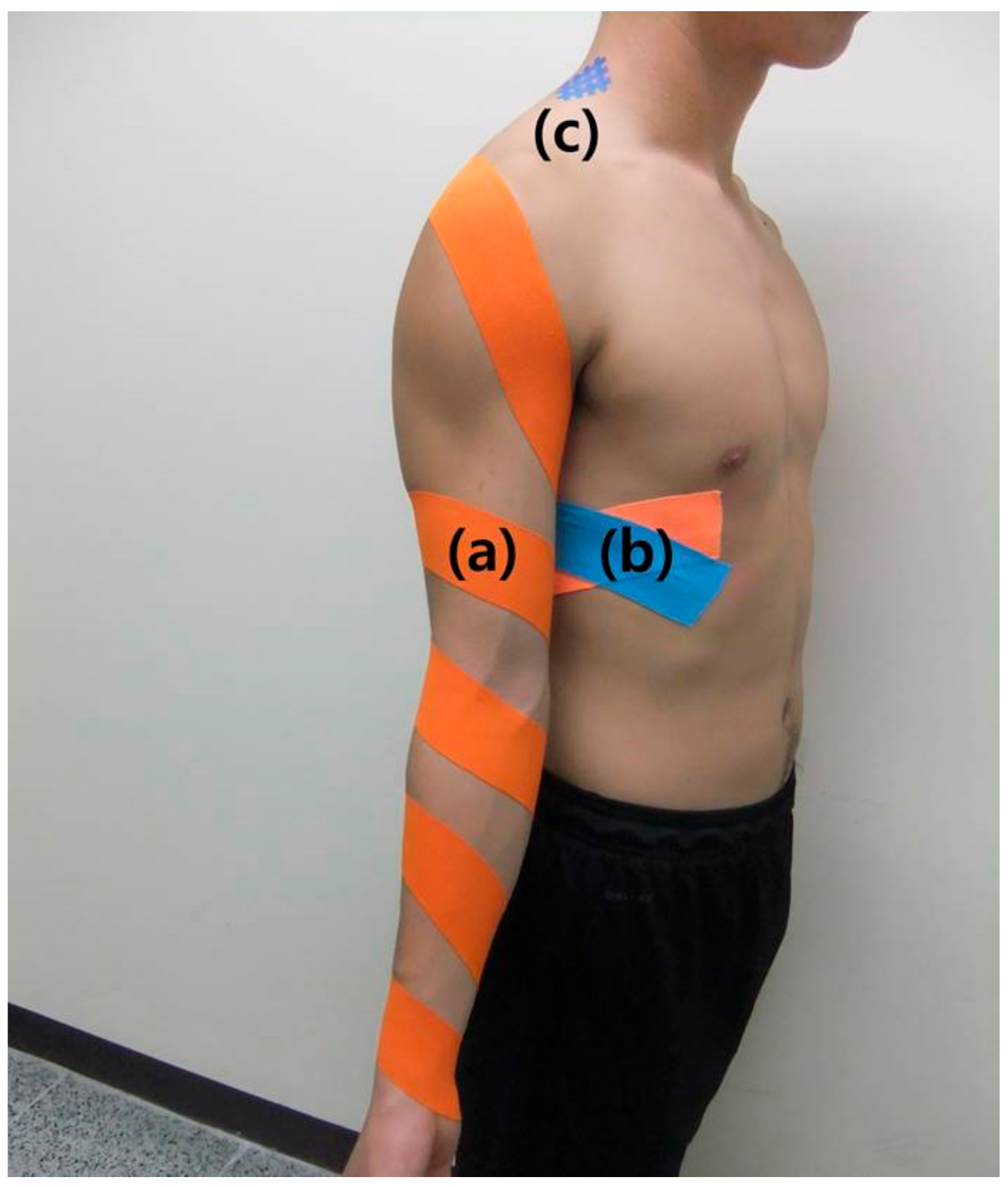 K-Taping in neurology as a therapy addition