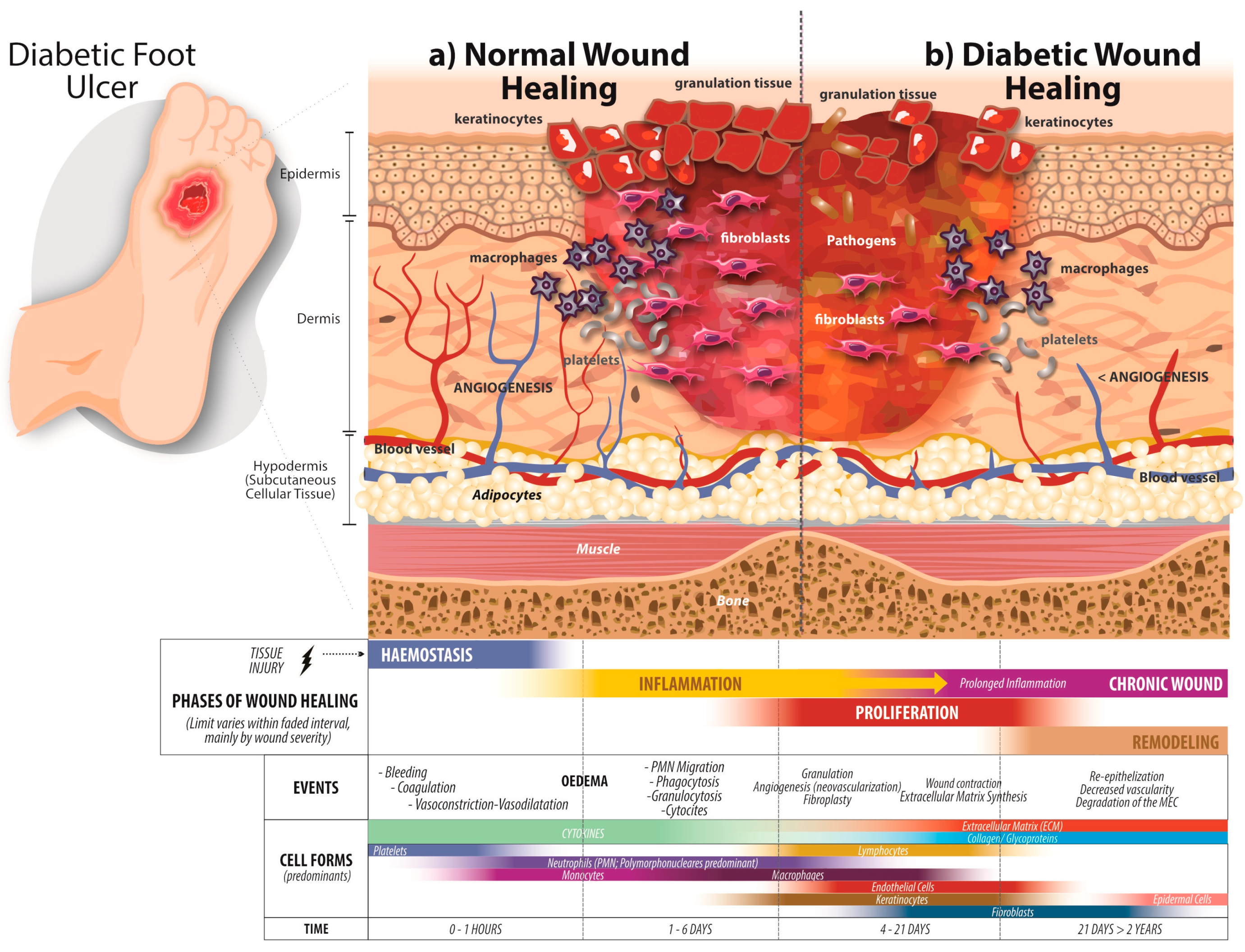 diabetes wound sebek kezelése