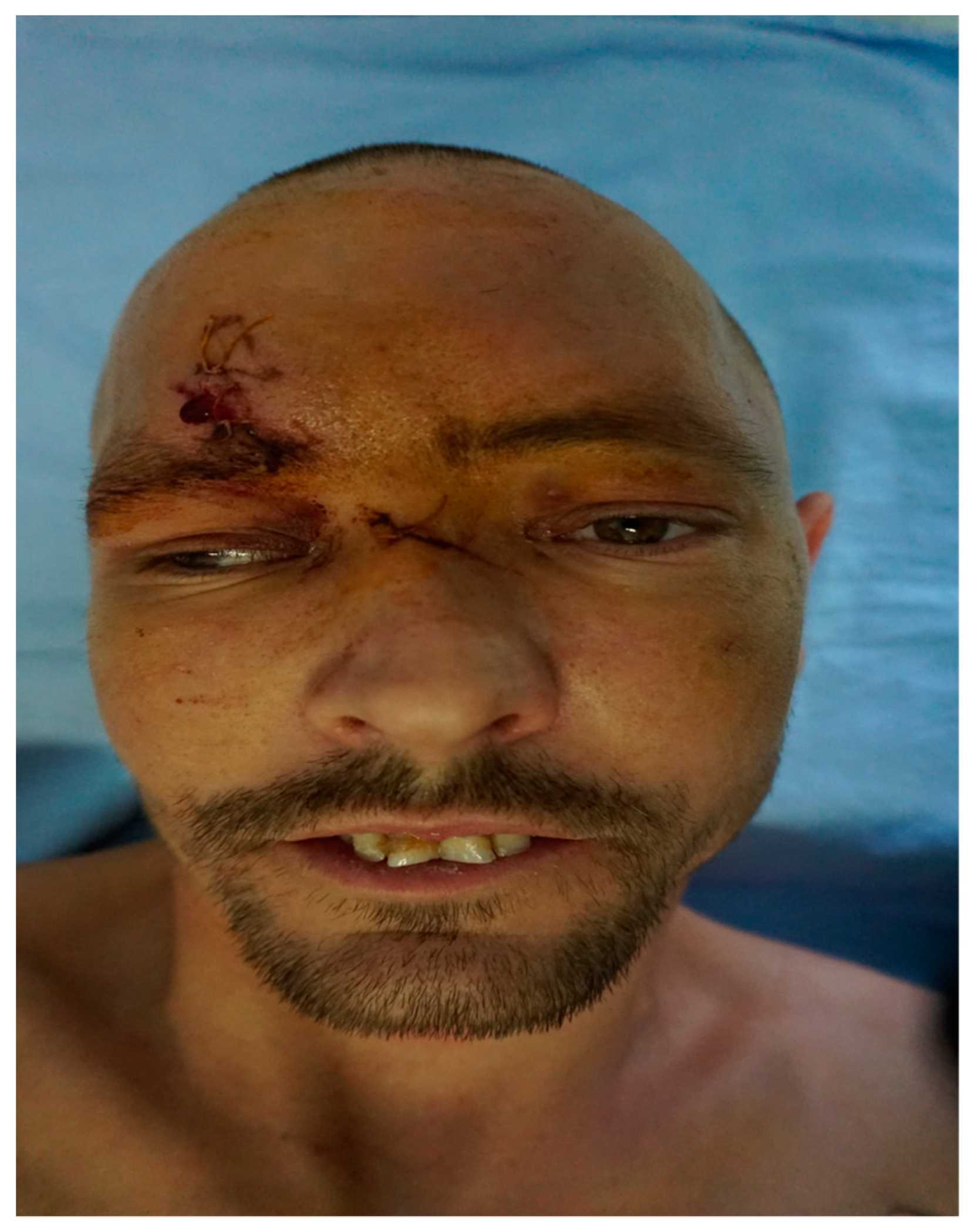 Medicina 55 00731 g004 Medicina 55 00731 g004