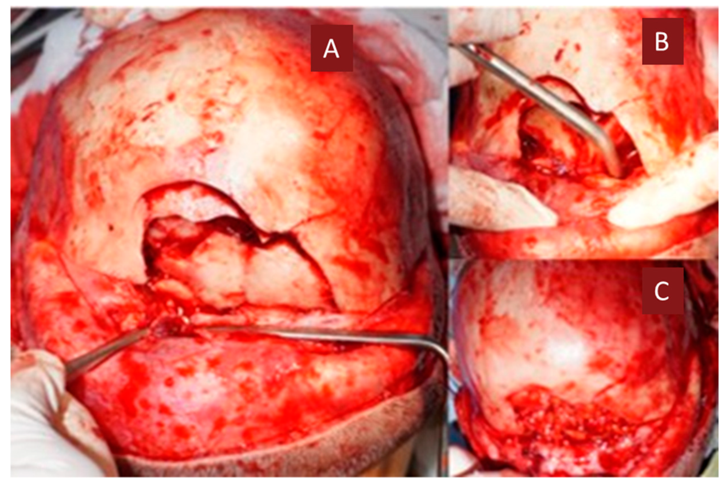 Medicina 55 00731 g005 Medicina 55 00731 g005