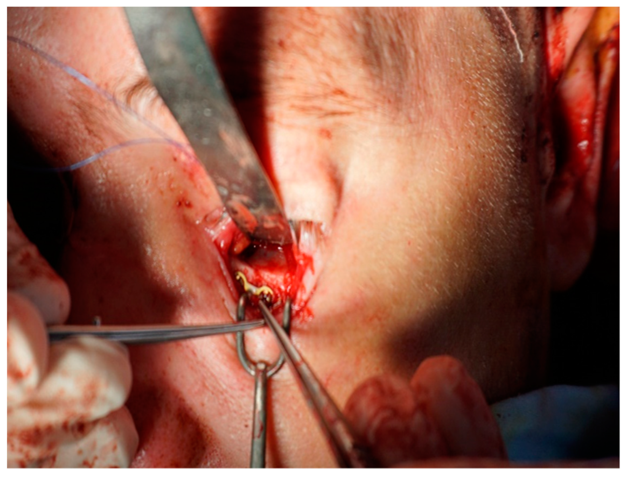 Medicina 55 00731 g007 Medicina 55 00731 g007