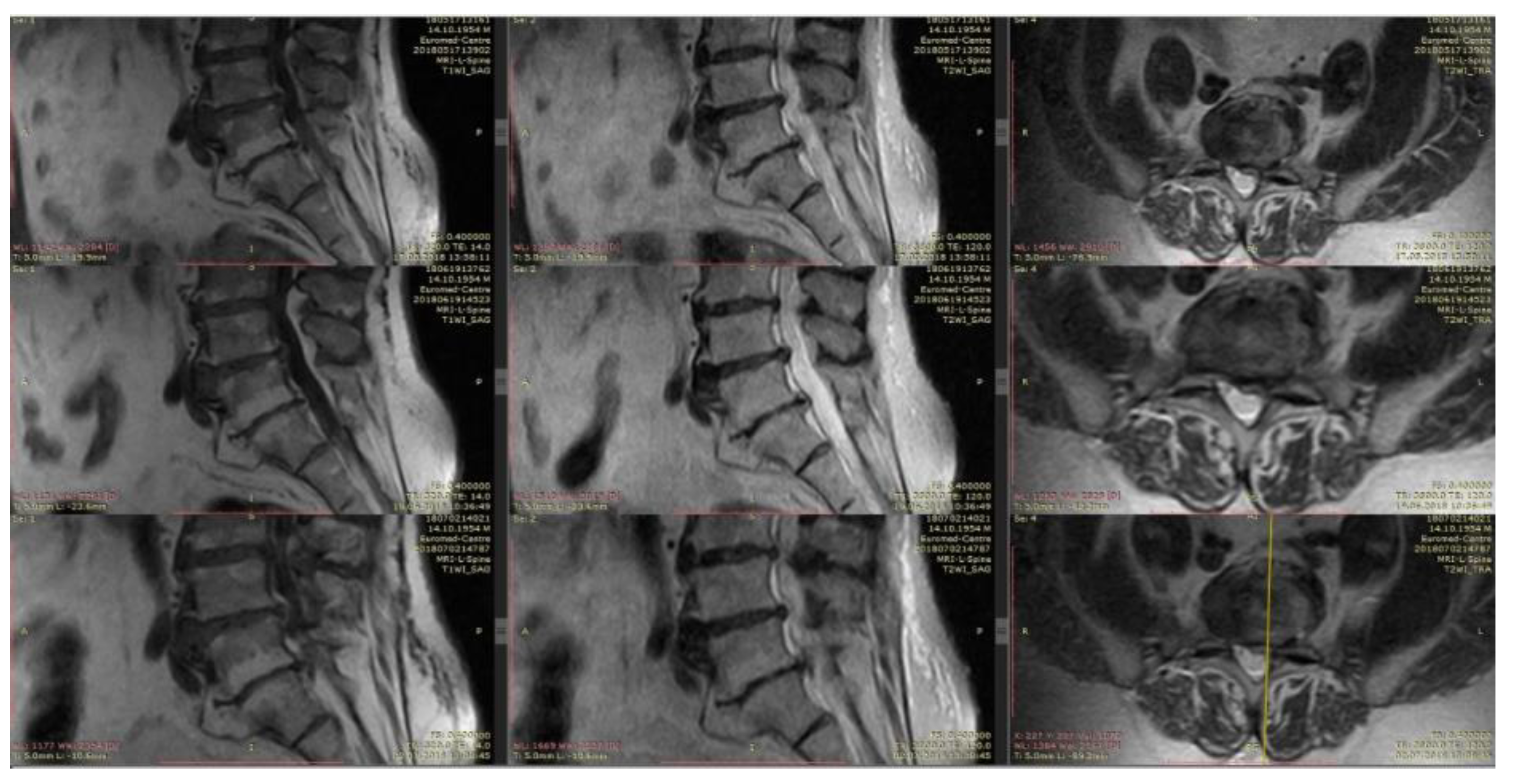 Medicina 55 00736 g006
