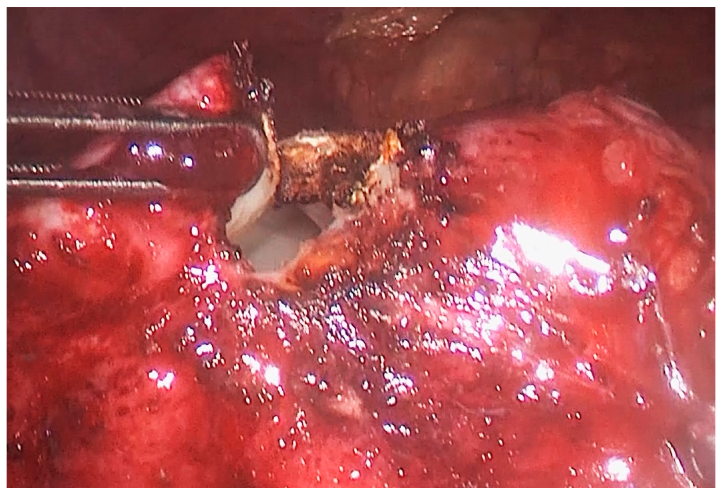 Medicina 55 00771 g002