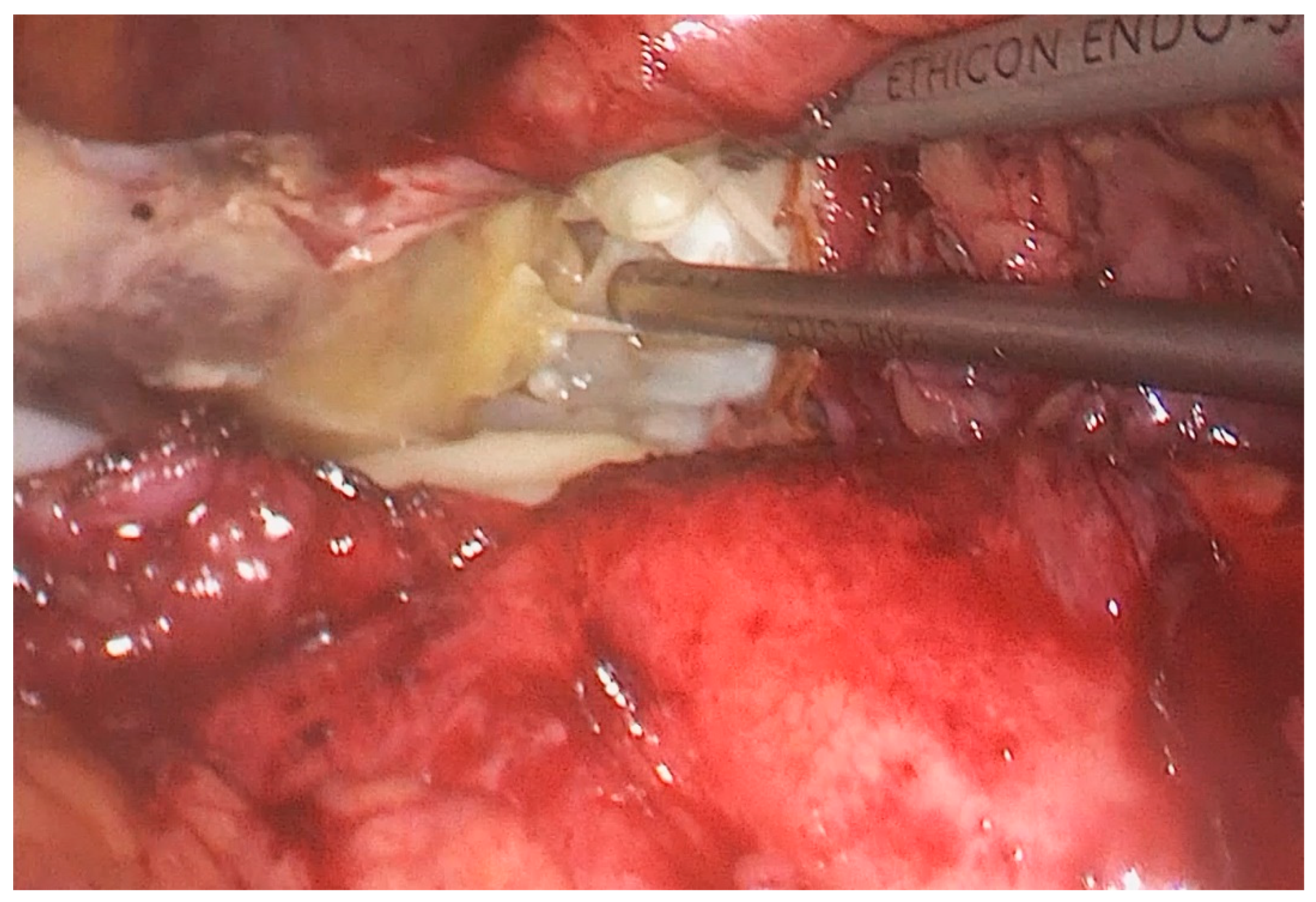 Medicina 55 00771 g003