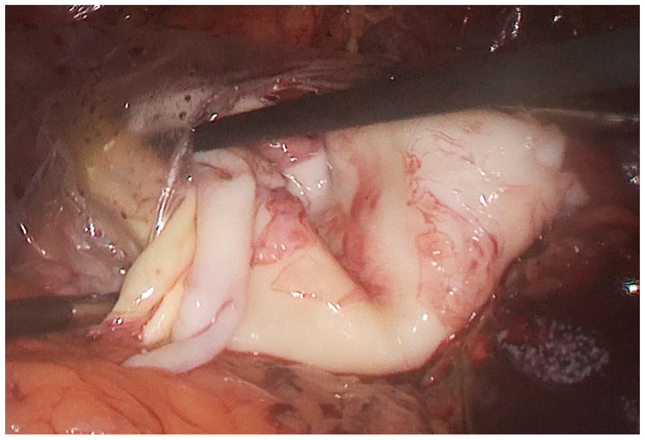 Medicina 55 00771 g004