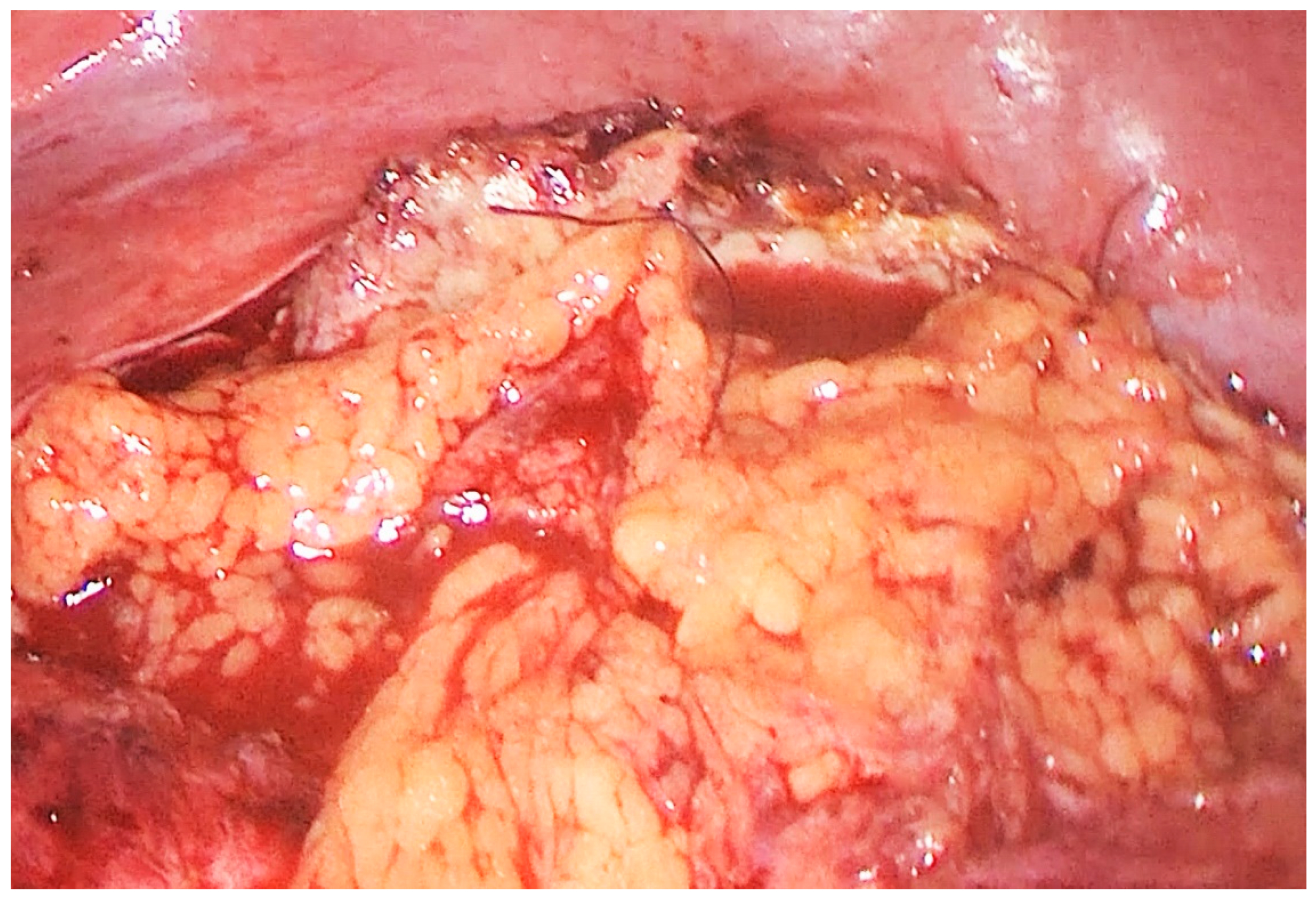 Medicina 55 00771 g005