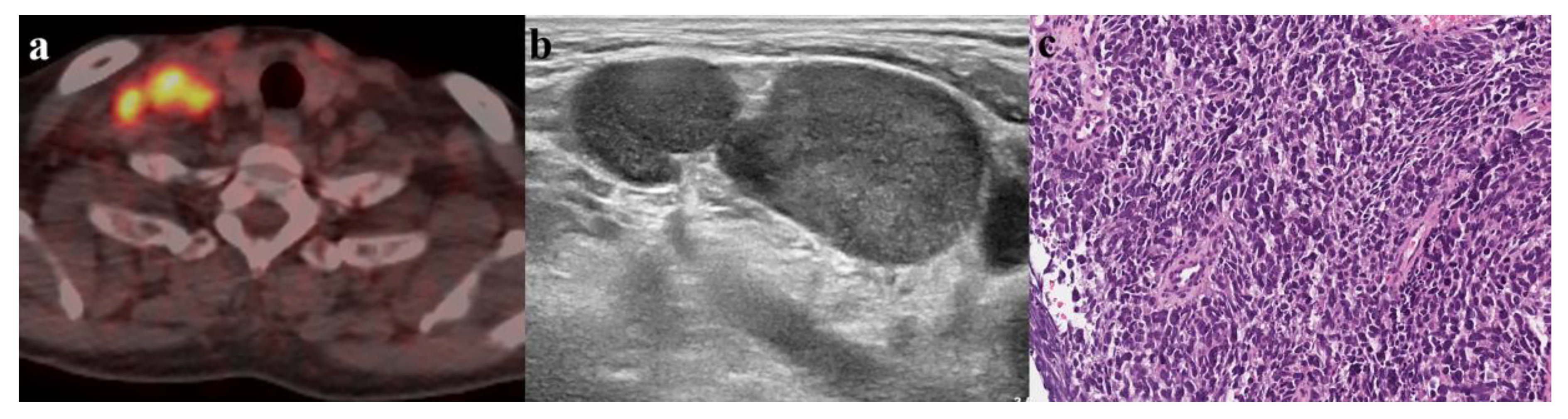 Medicina 56 00016 g003