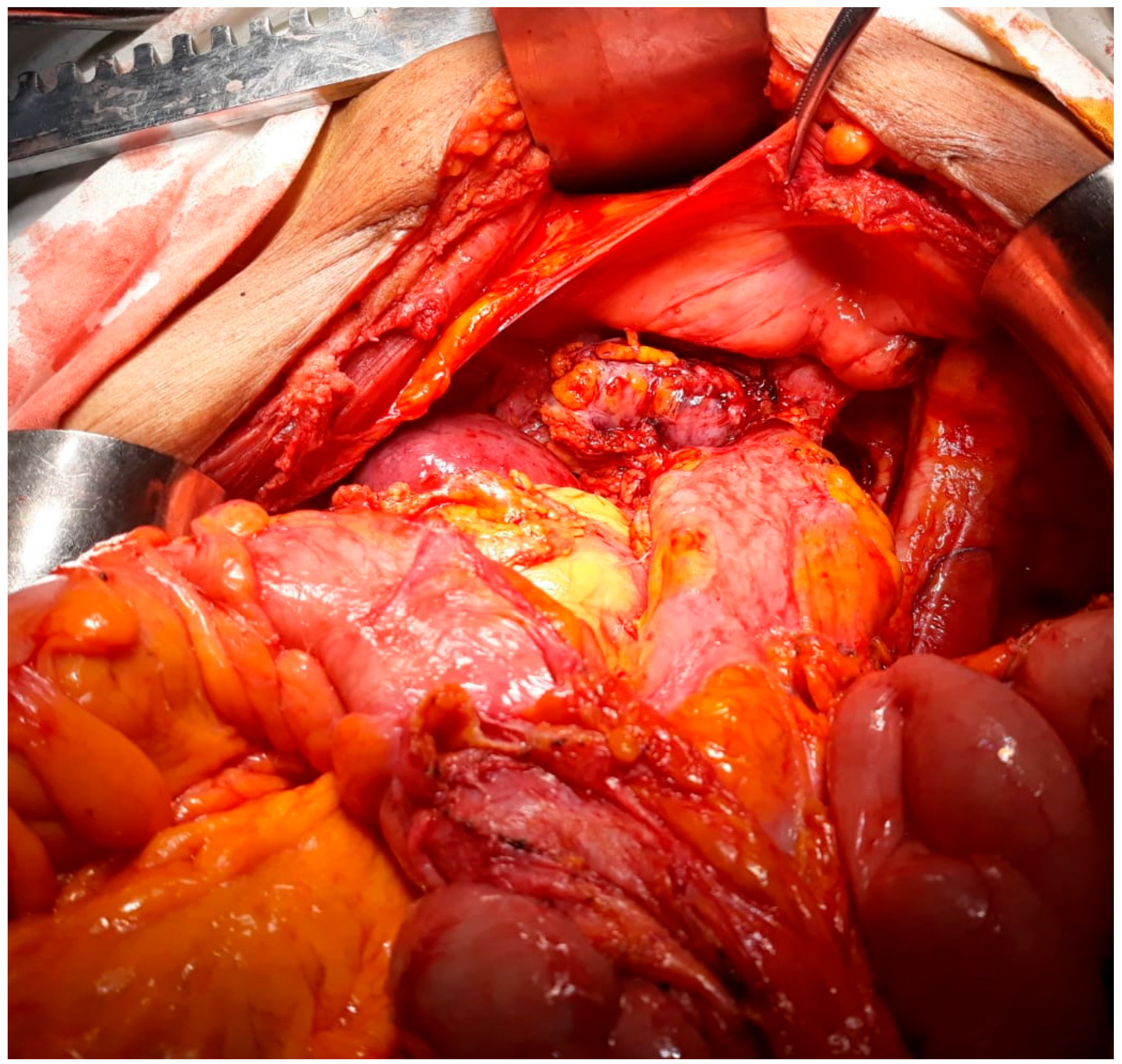 Medicina 56 00033 g001