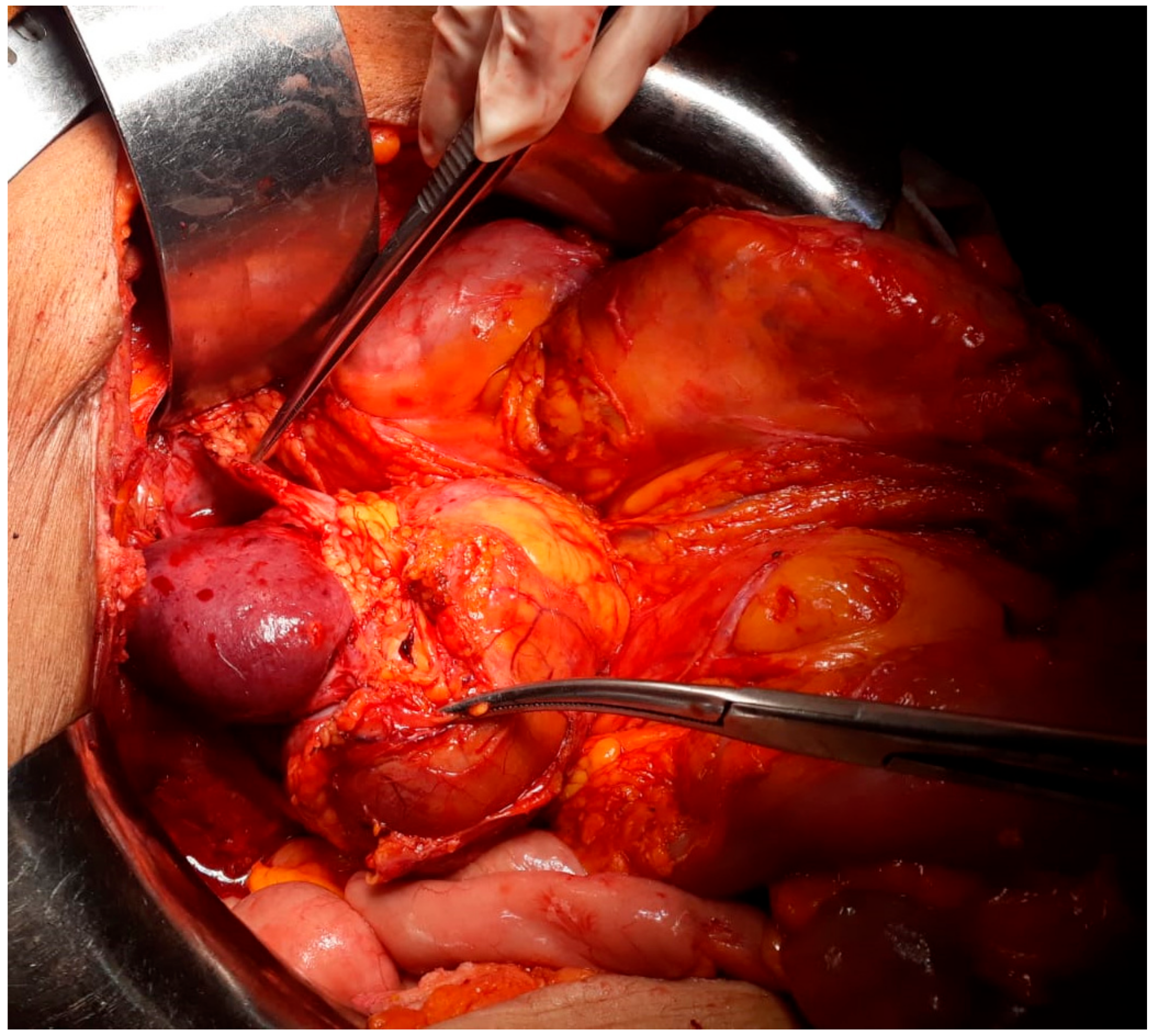 Medicina 56 00033 g002