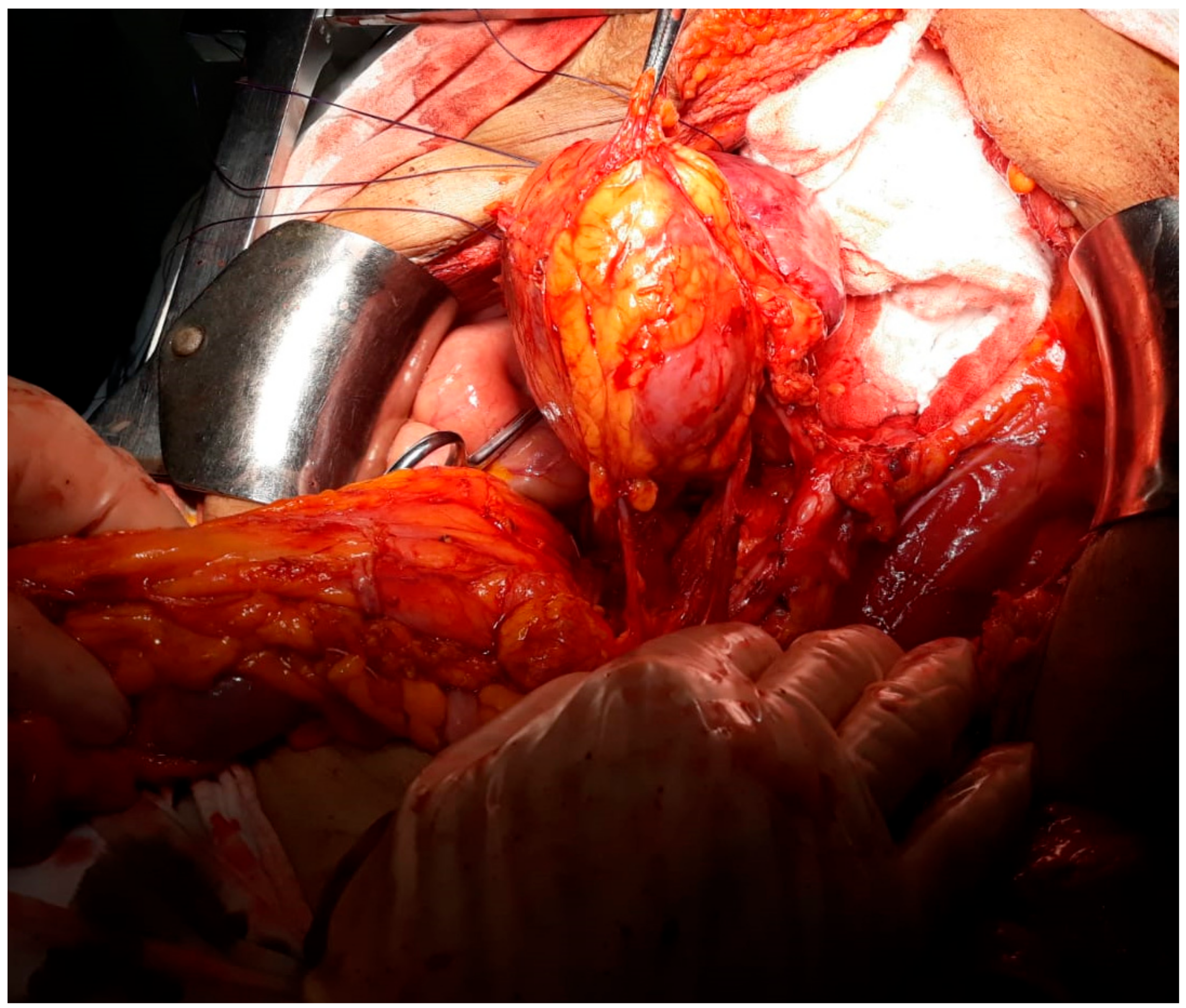 Medicina 56 00033 g003