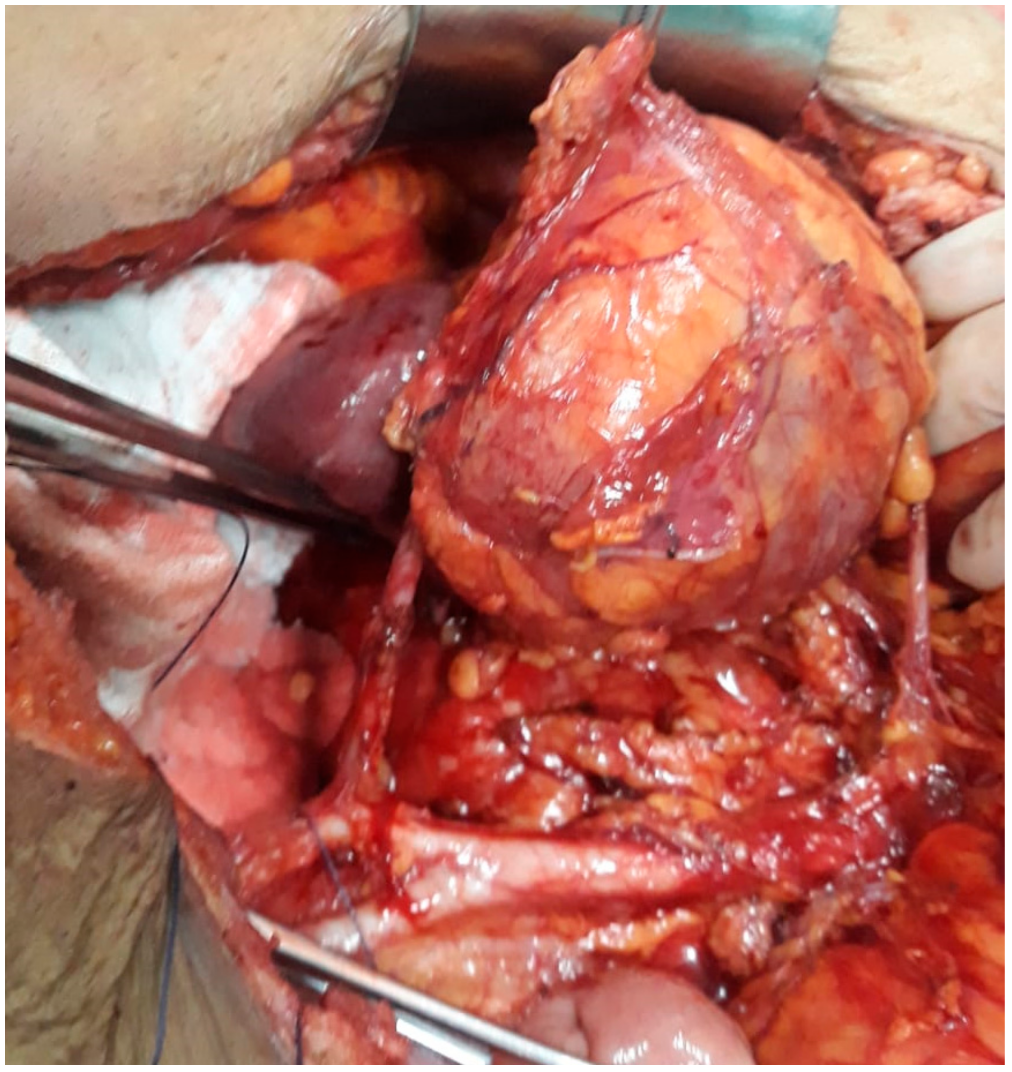 Medicina 56 00033 g004