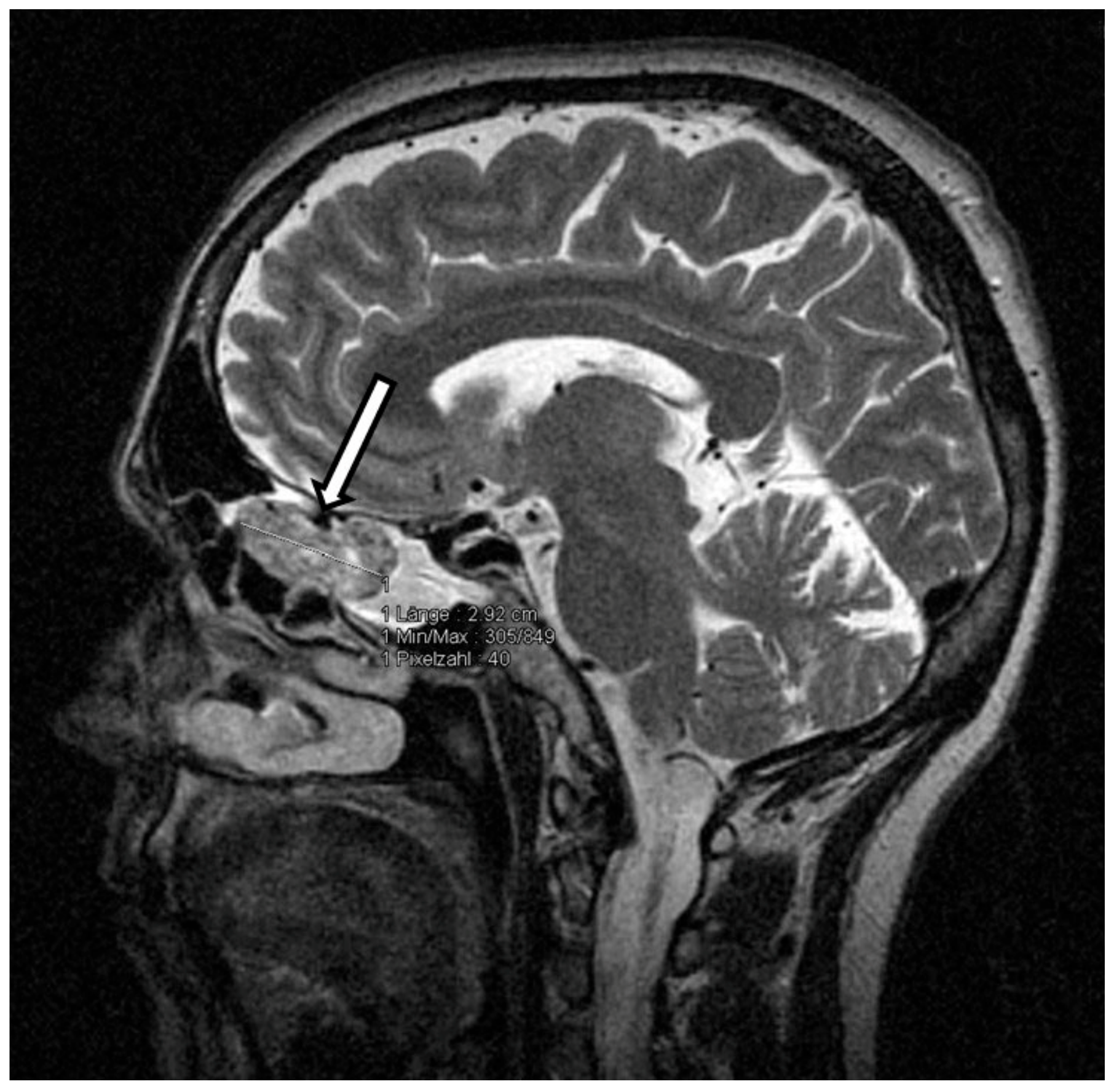 Medicina 56 00034 g001 550