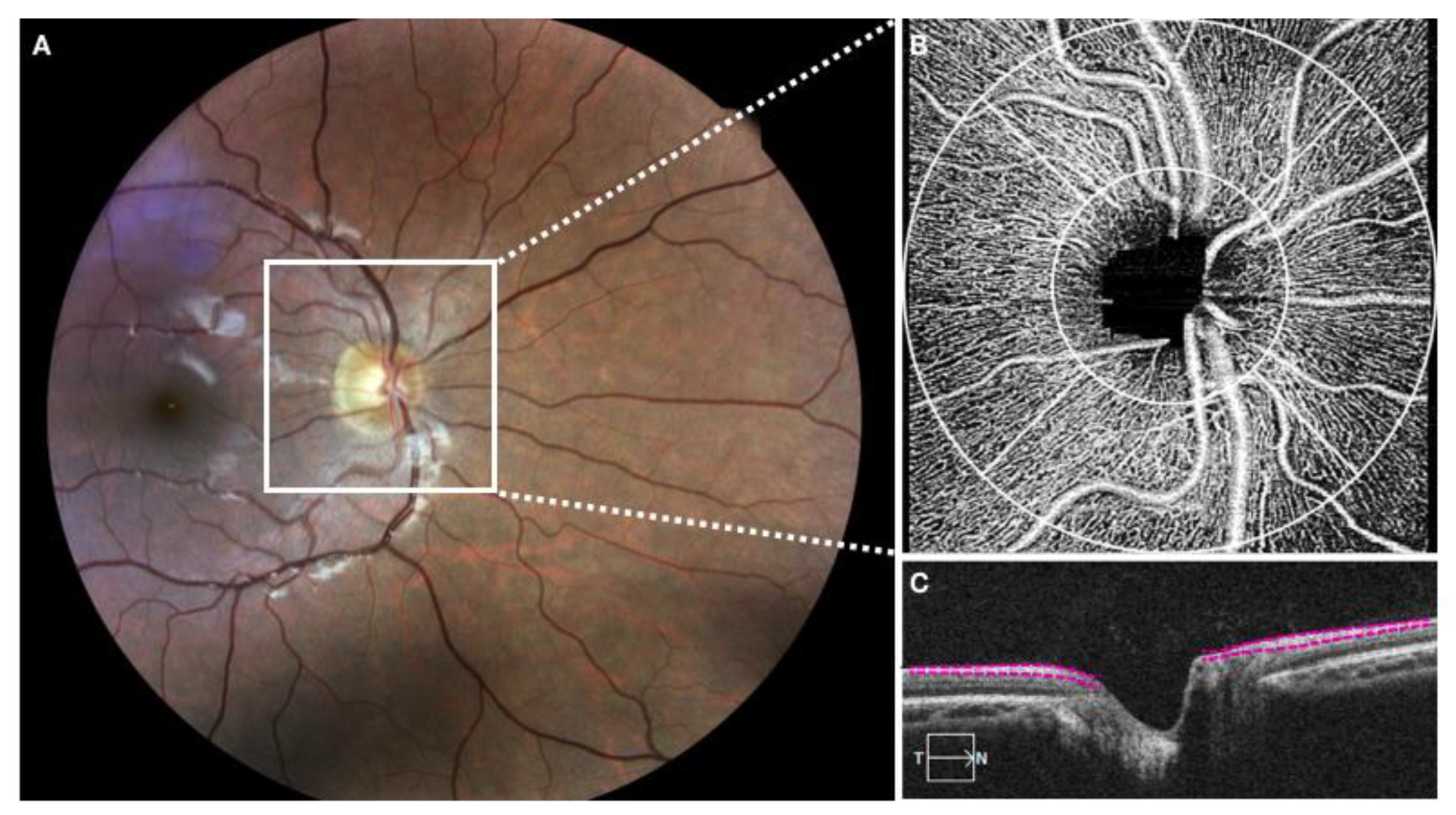Medicina 56 00044 g001