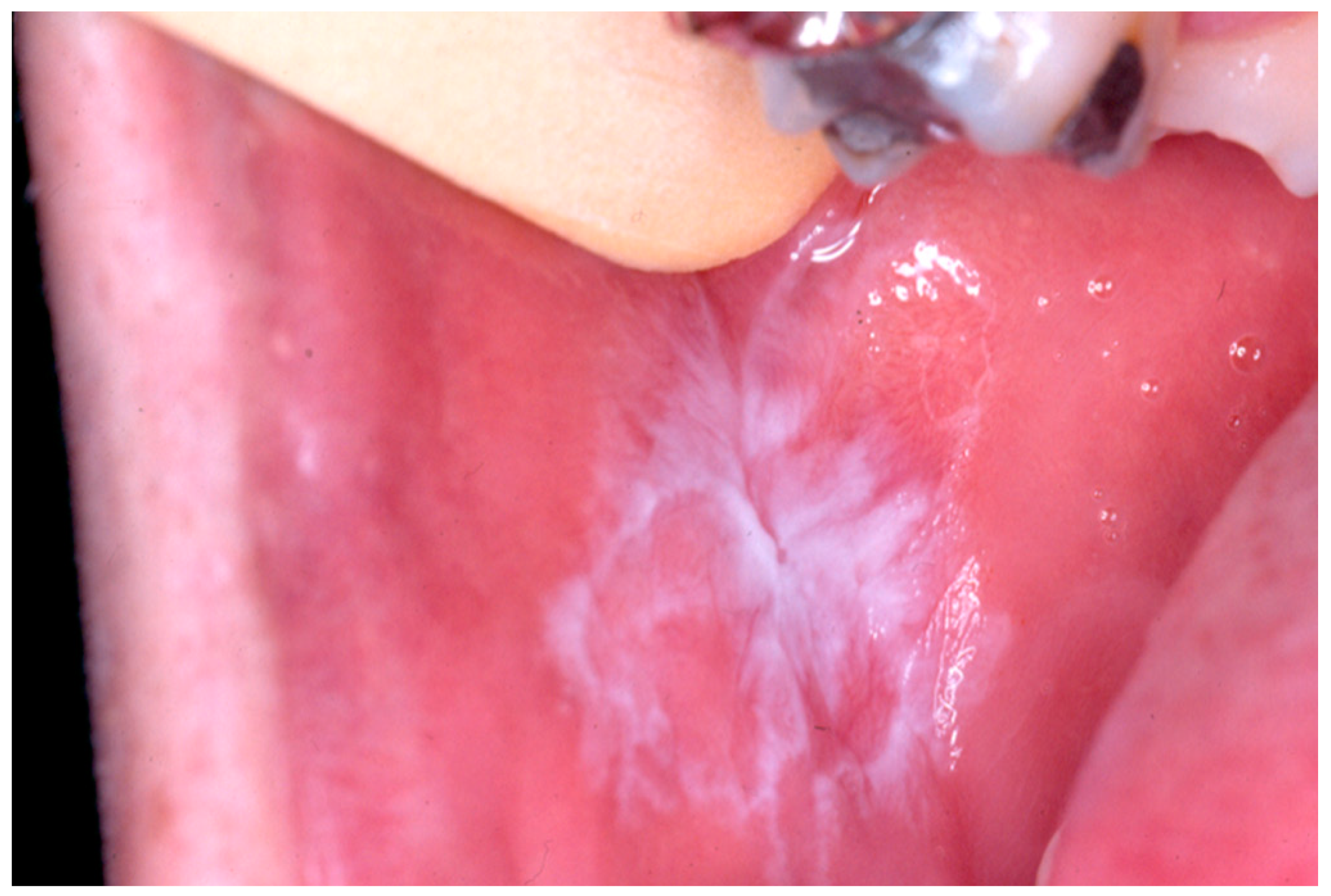 Medicina 56 00053 g003