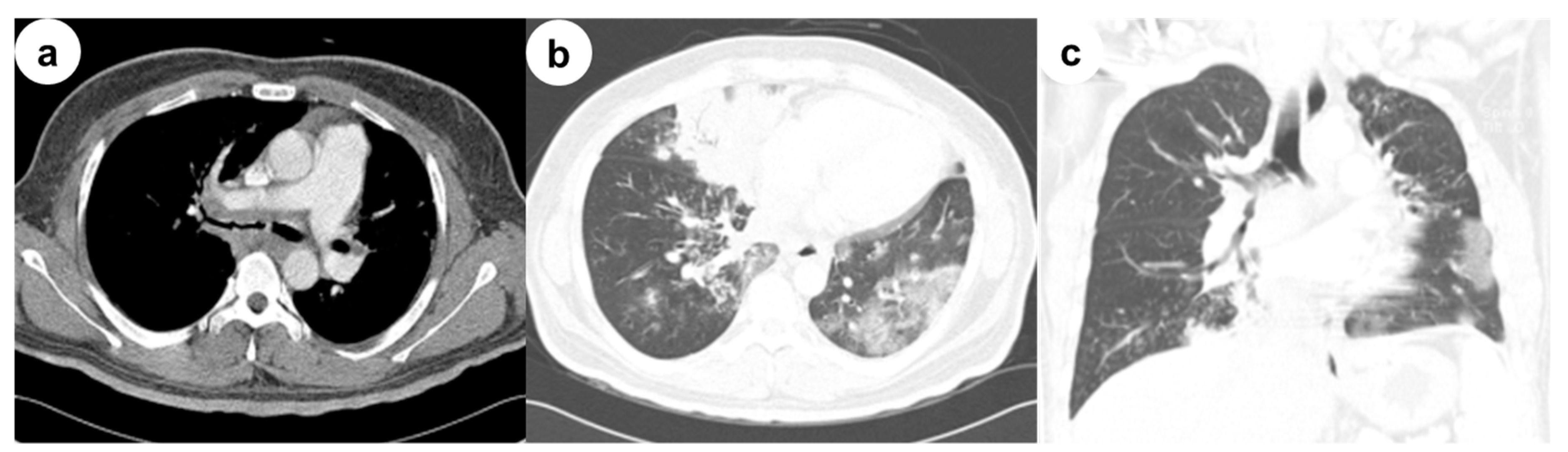 Medicina 56 00064 g001