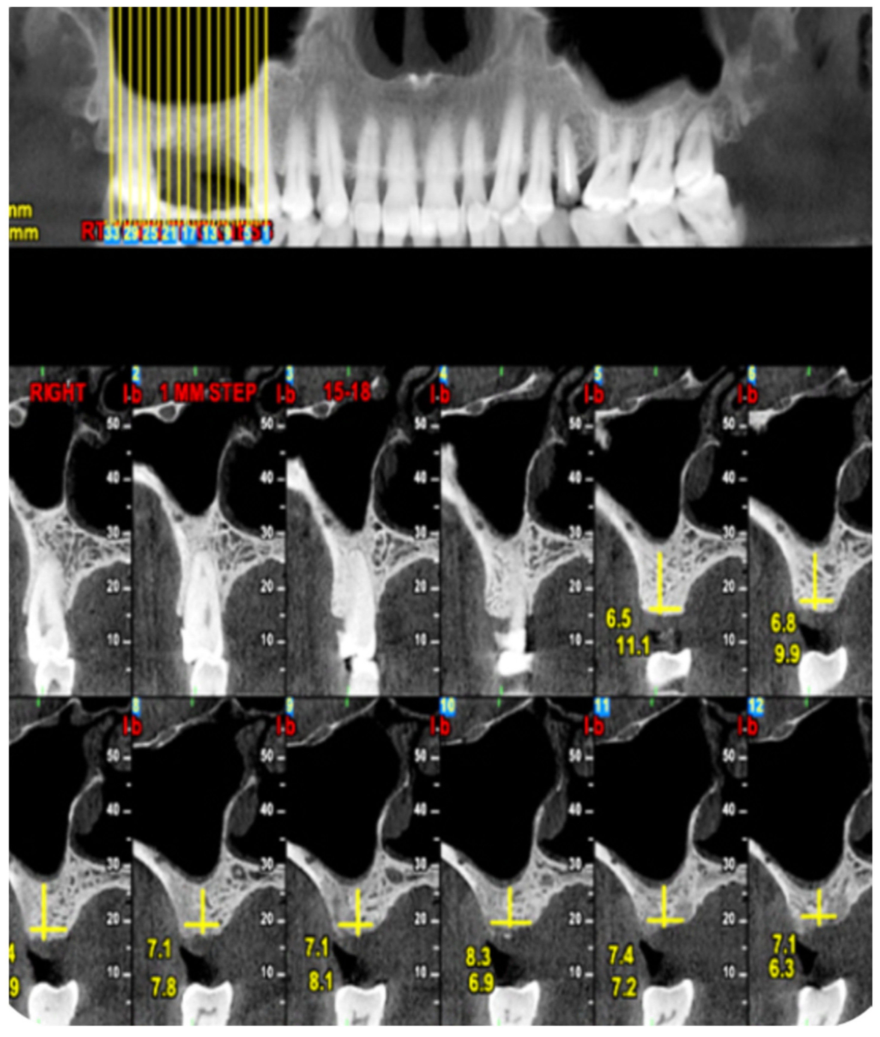 Medicina 56 00075 g001