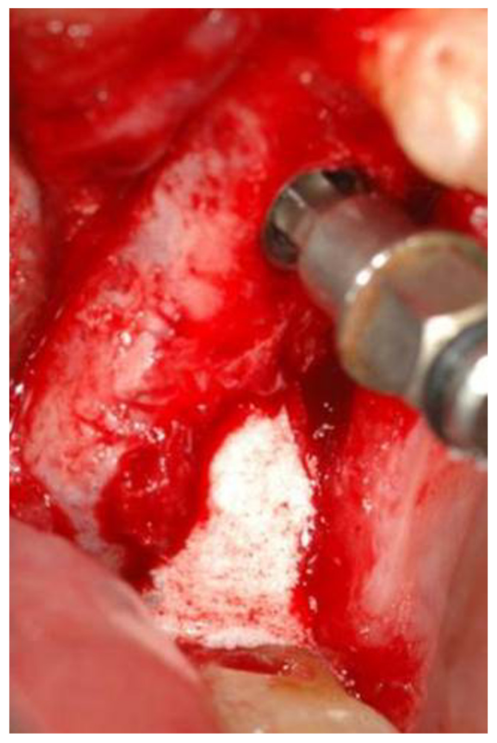 Medicina 56 00075 g005