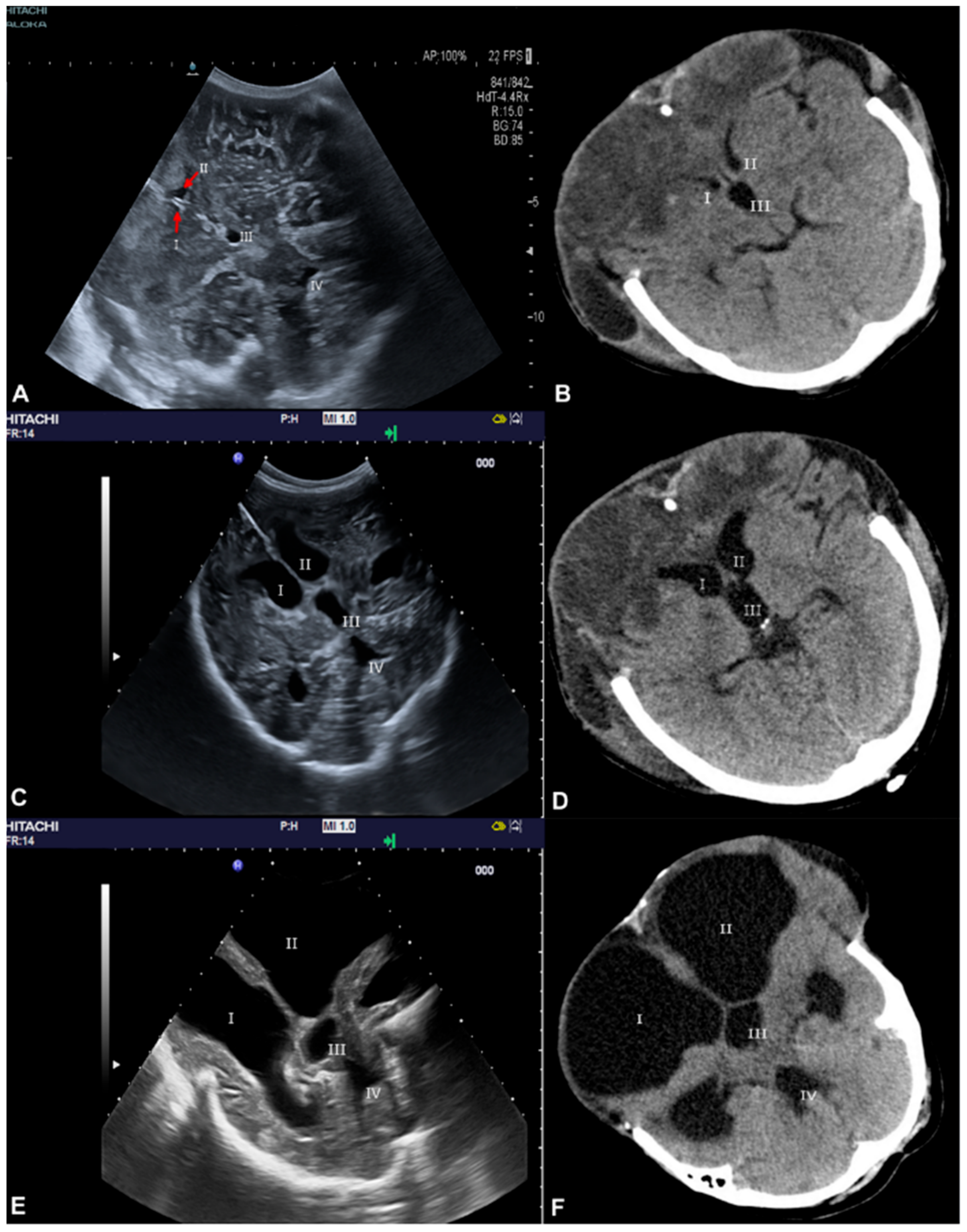 Medicina 56 00085 g002