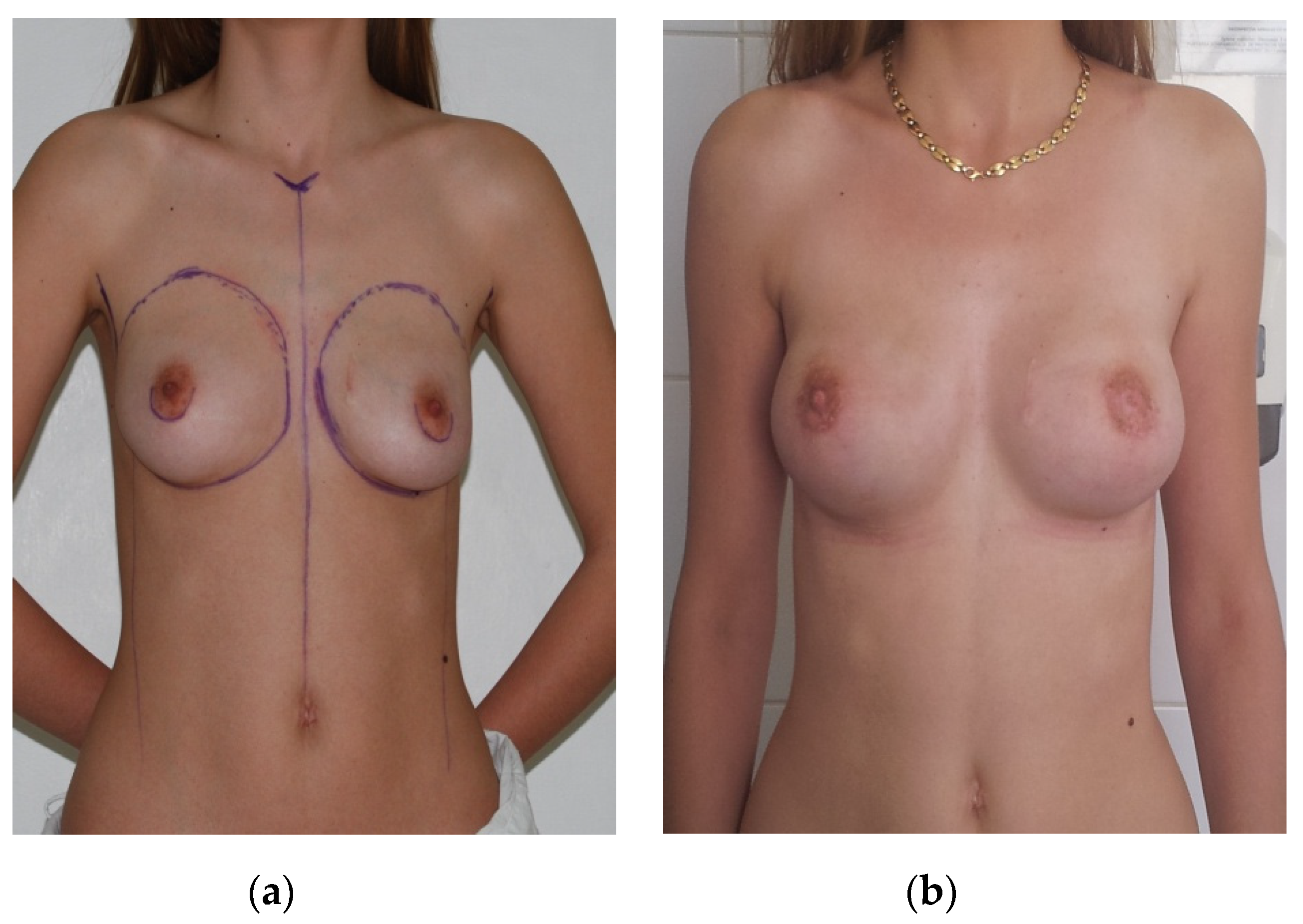 Medicina 56 00086 g001