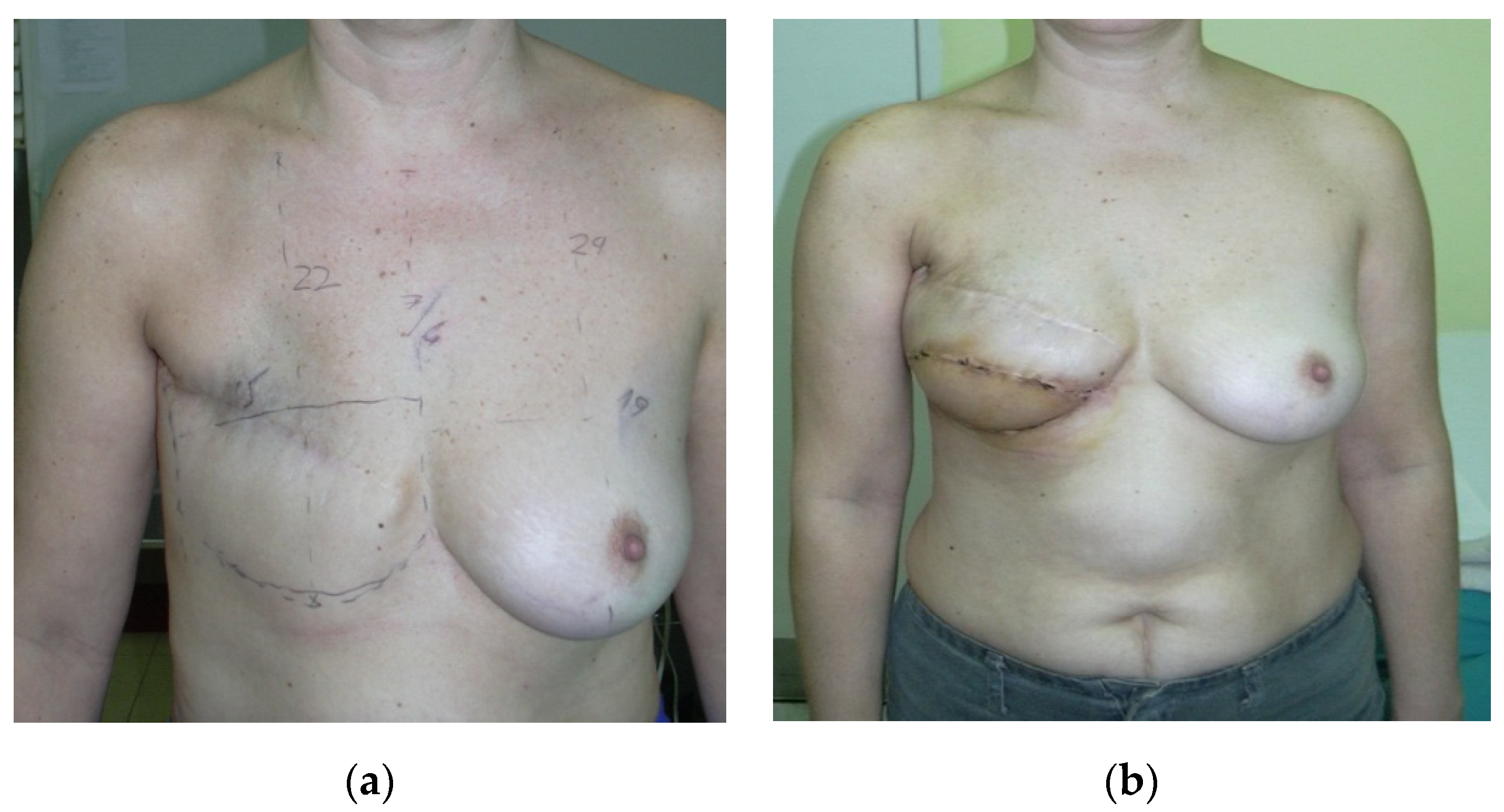 Medicina 56 00086 g002