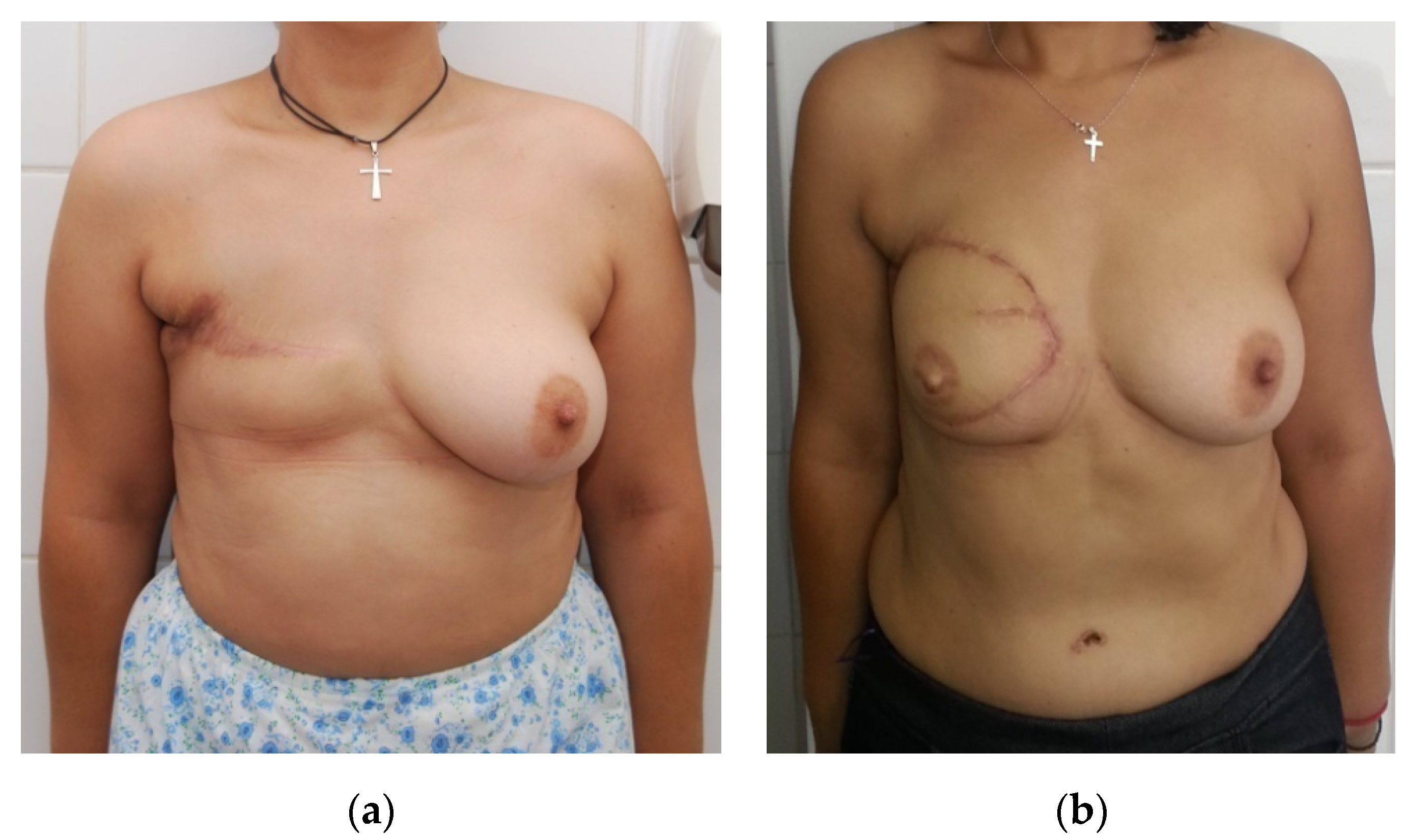 Medicina 56 00086 g003